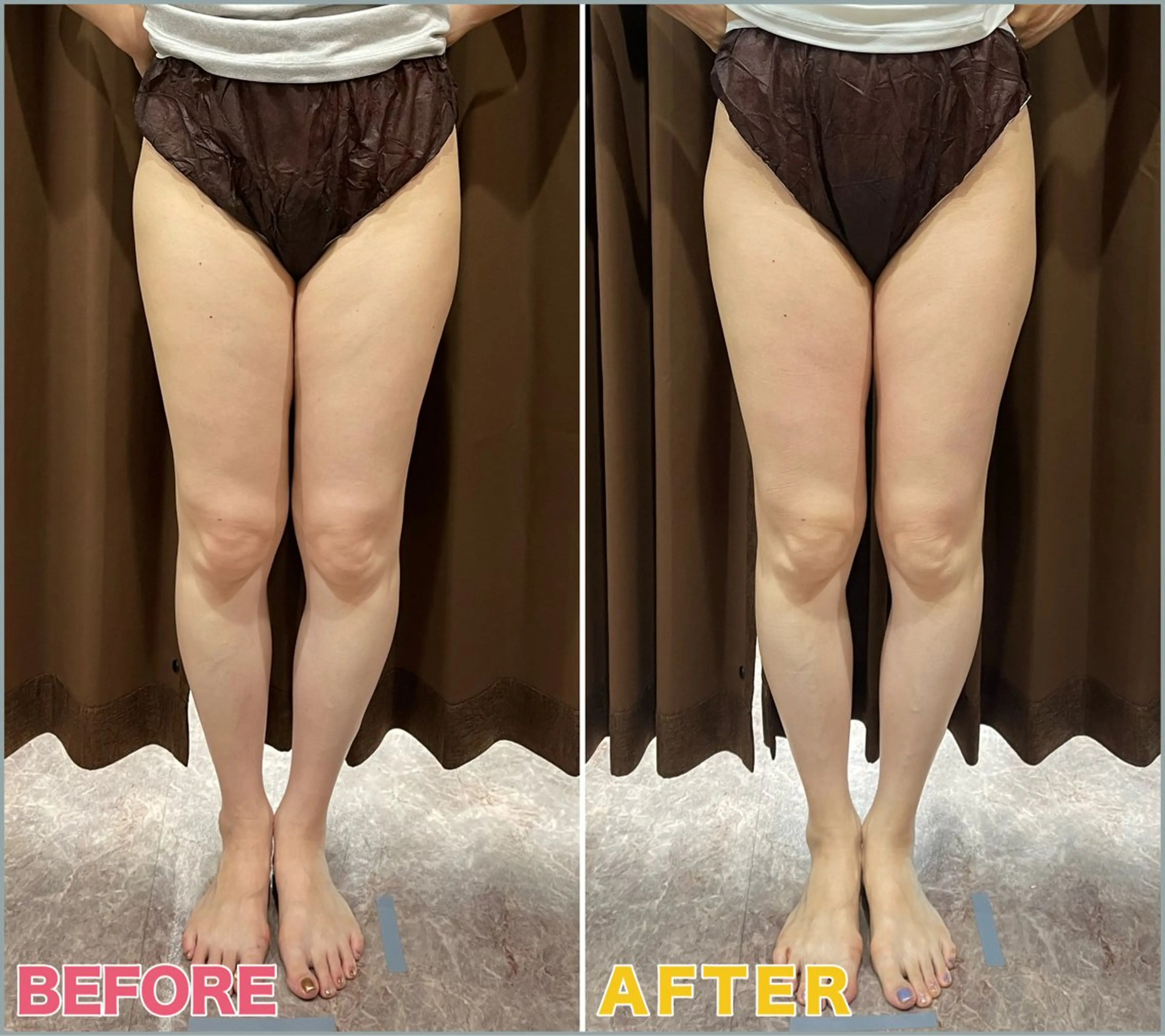 エステ VIVACE YUMEのその他イメージ