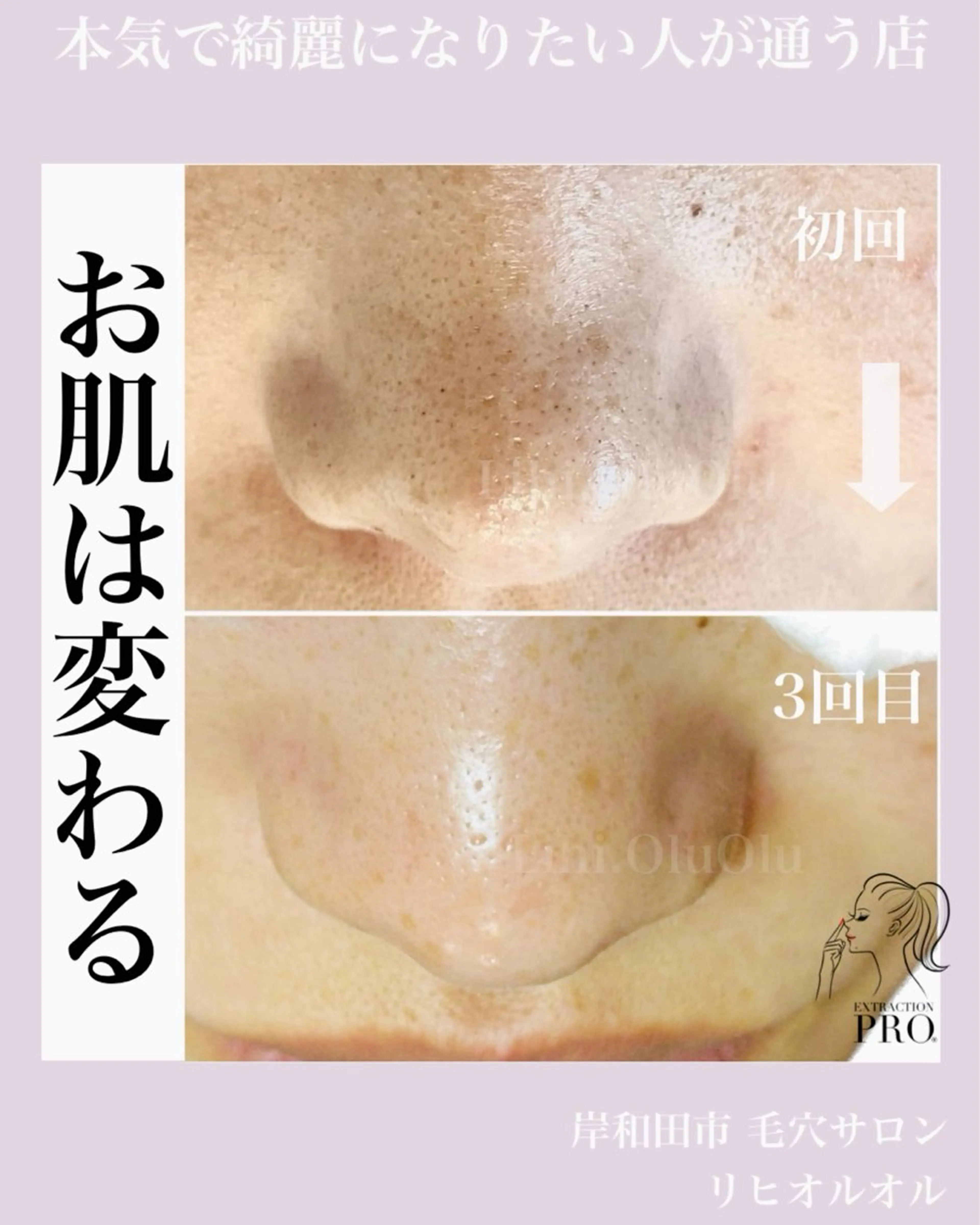 毛穴汚れ改善専門店/ 岸和田/リヒオルオルのエステ・リラクイメージ
