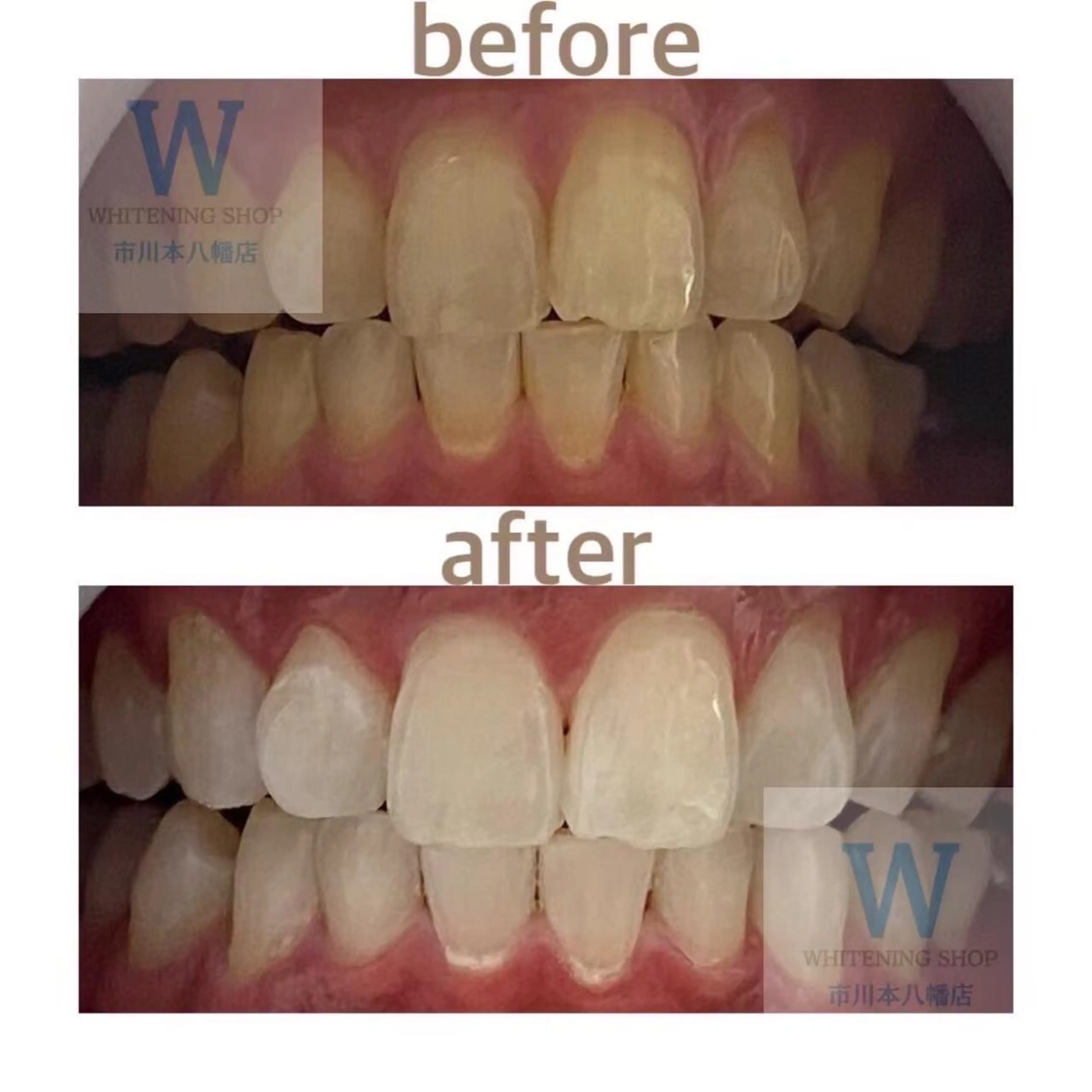 ホワイトニング ショップ本八幡店のエステ・リラクイメージ