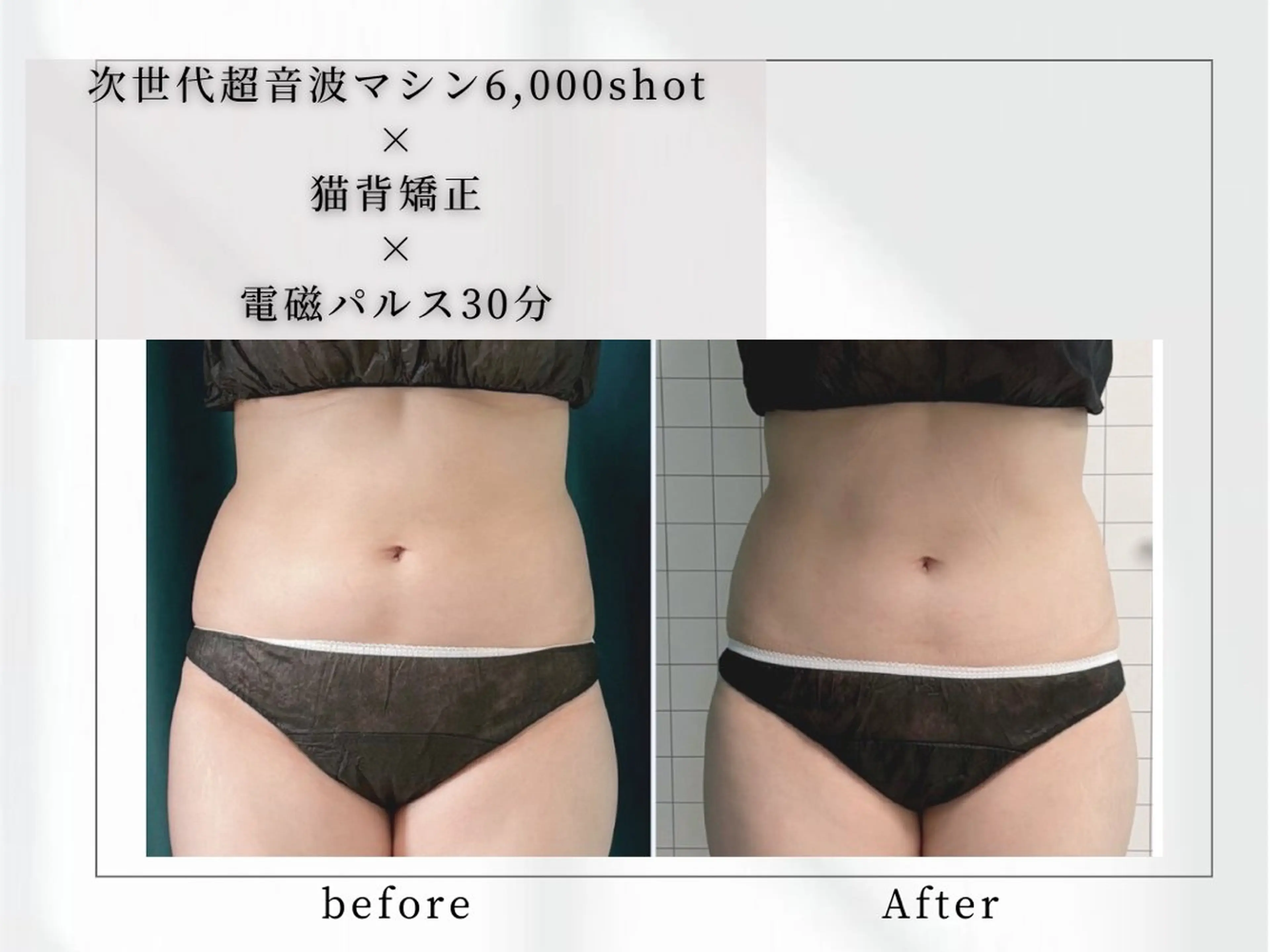 小顔矯正専門店 【RED】池田のエステ・リラクイメージ