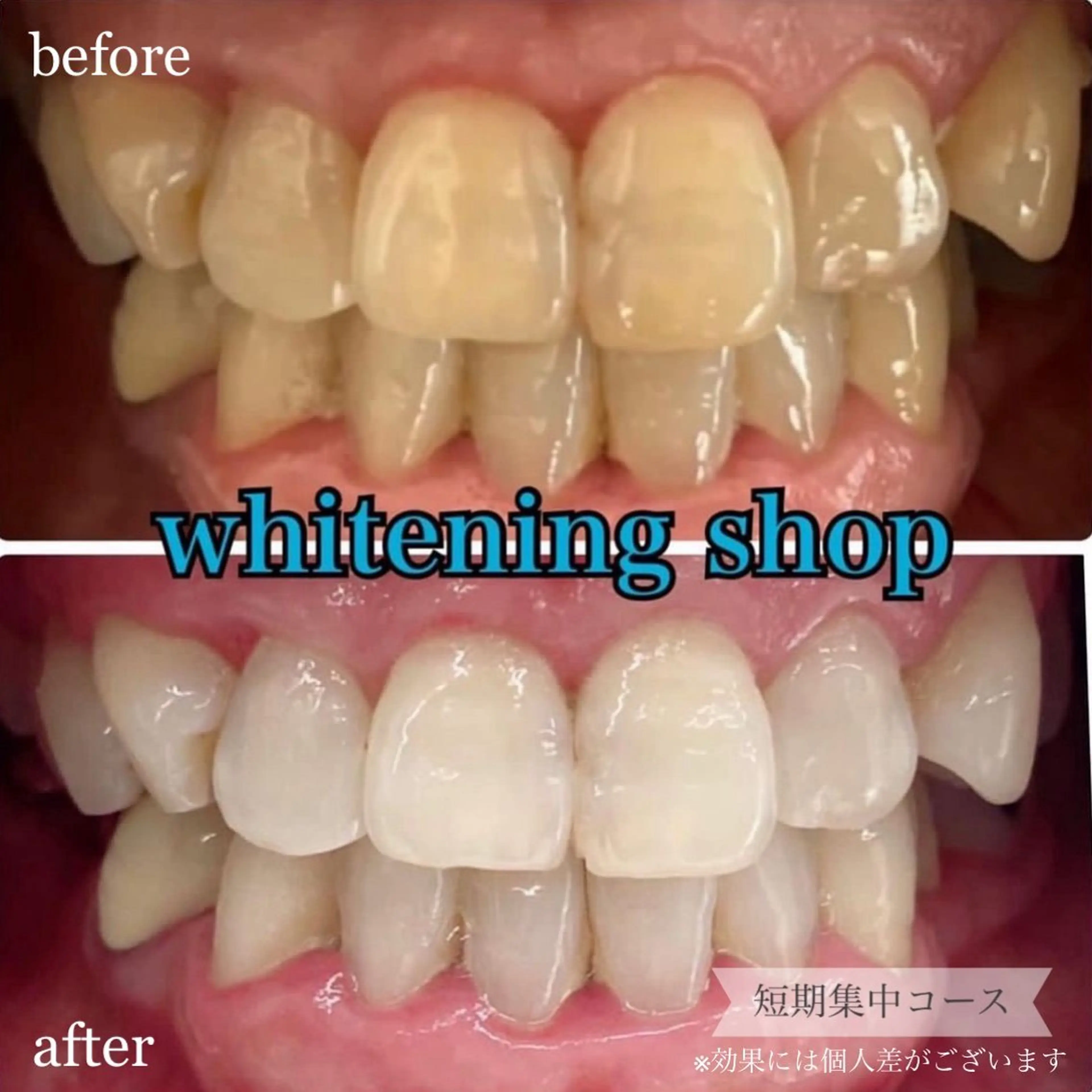 ホワイトニング ショップ桜木町店のエステ・リラクイメージ