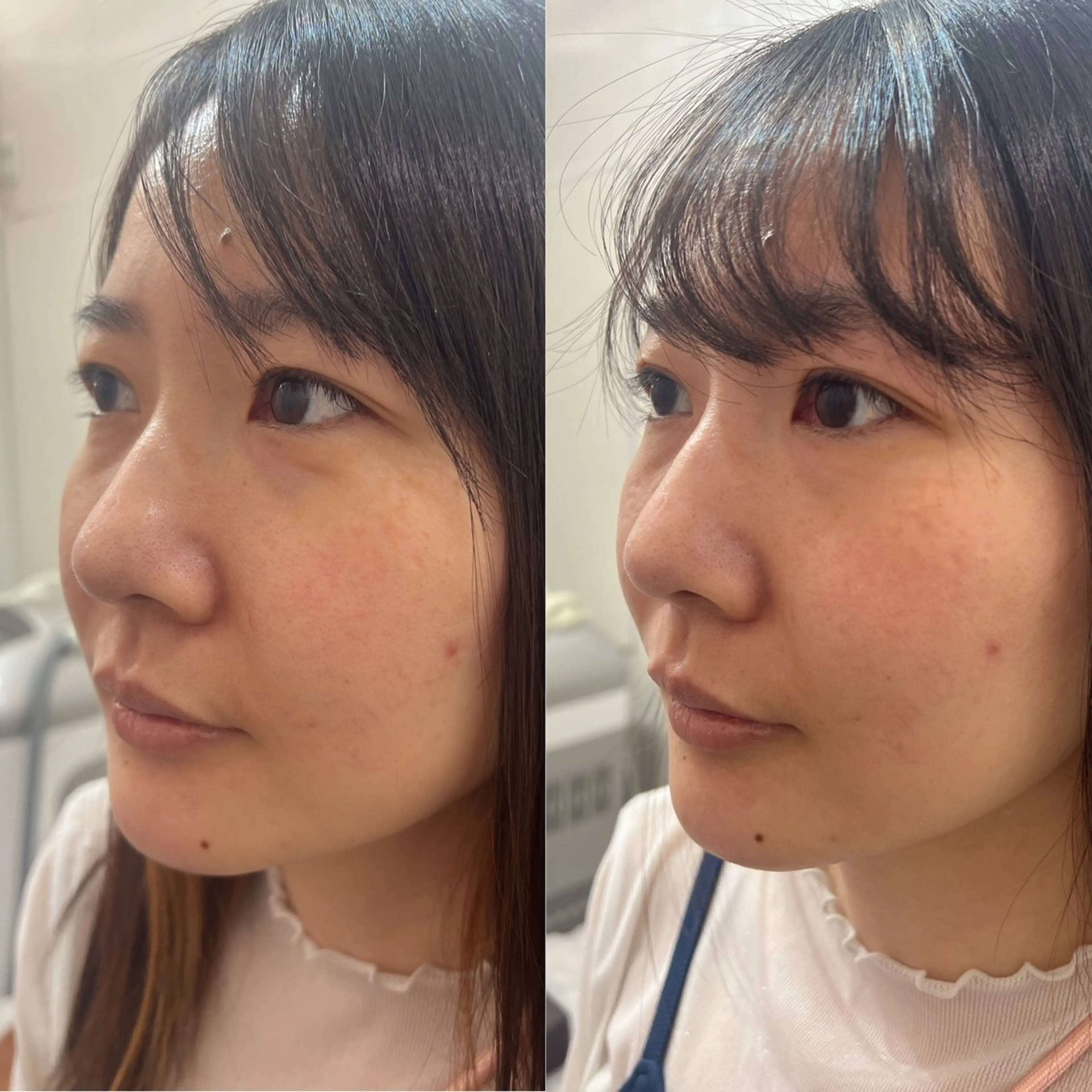 エステ 毛穴改善/脱毛 ネイル　川上久仁子のエステ・リラクイメージ