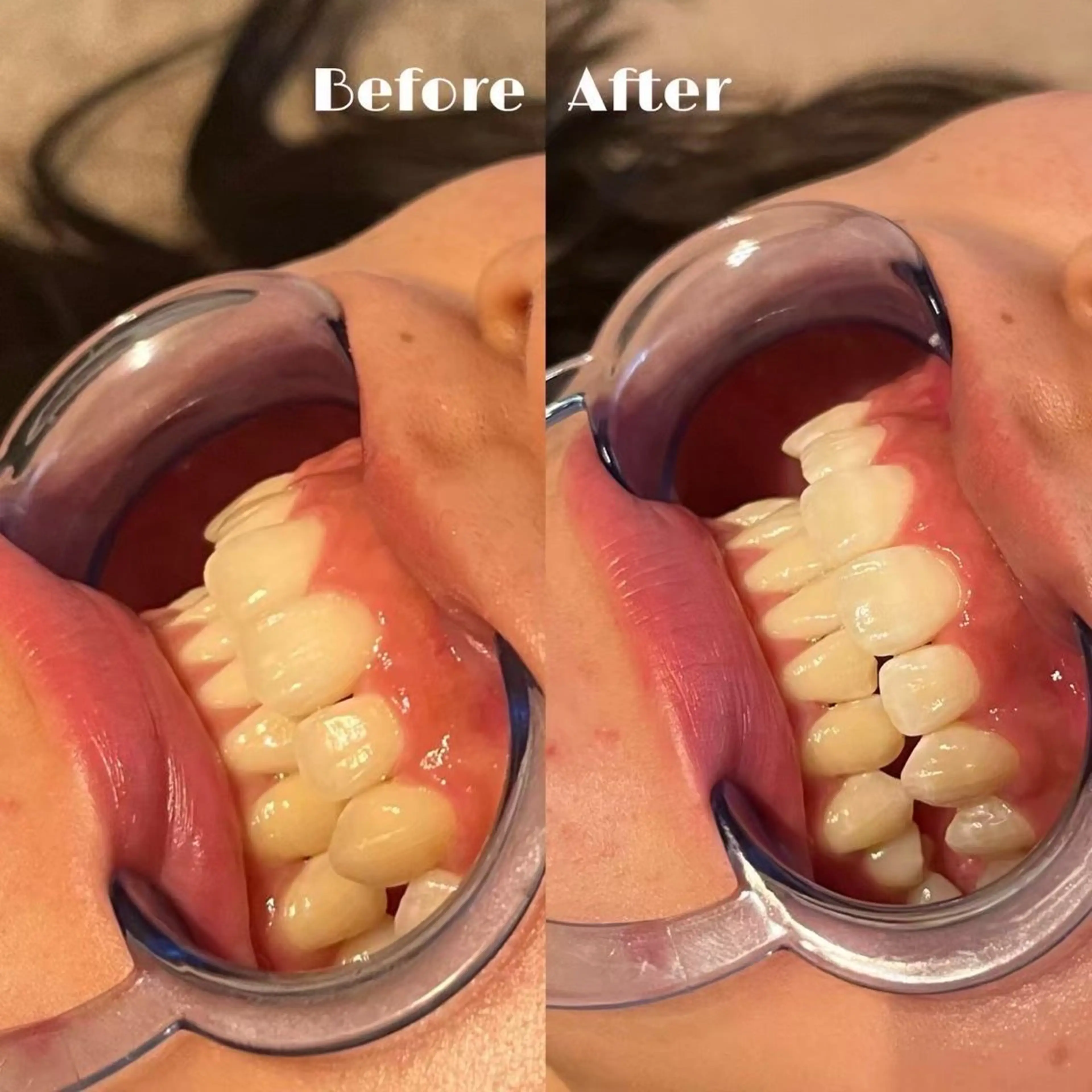 LUMIERE 南堀江店 n♡のエステ・リラクイメージ