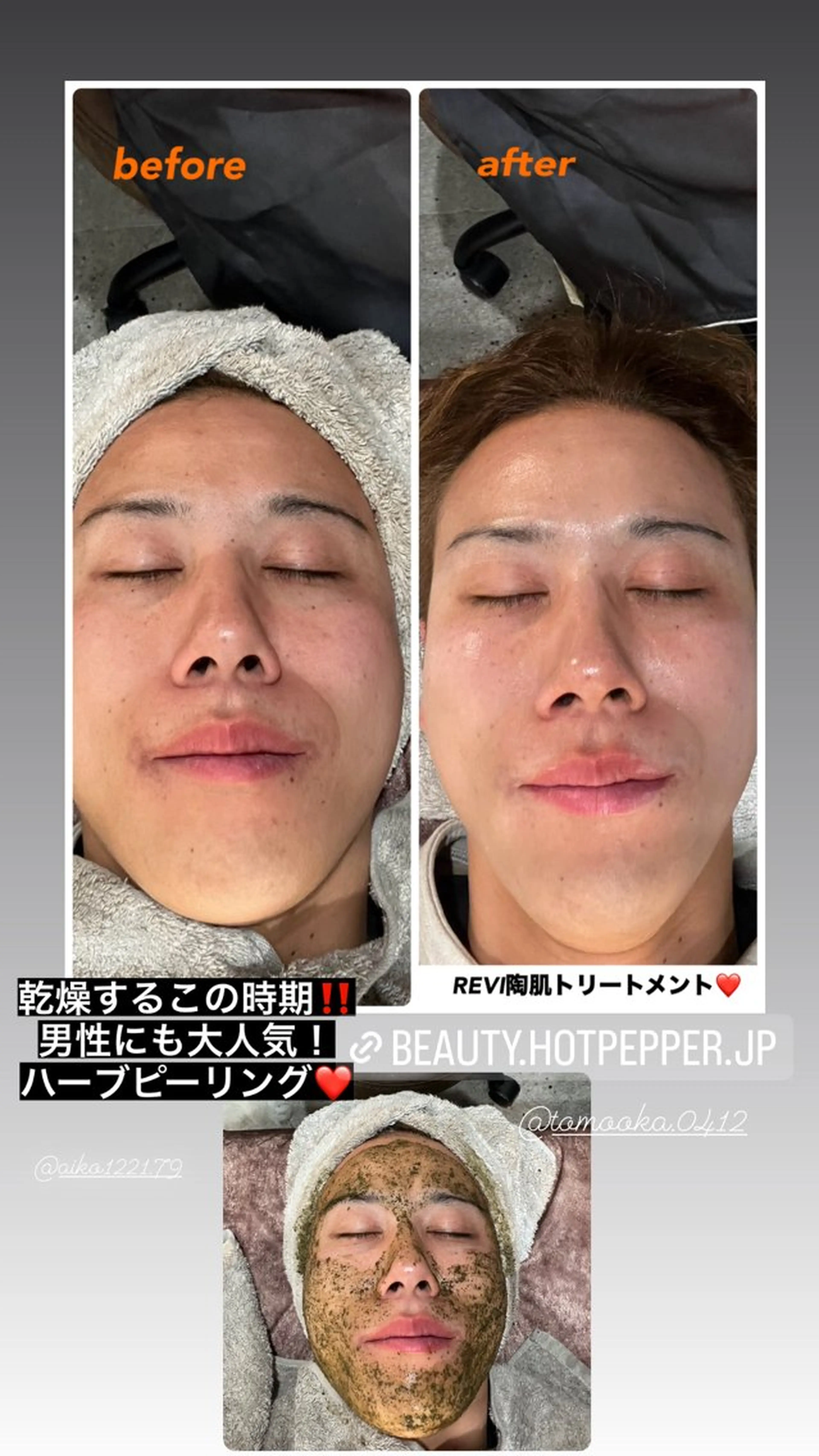 ハーブピーリング専門 毛穴洗浄❤️眉waxのエステ・リラクイメージ