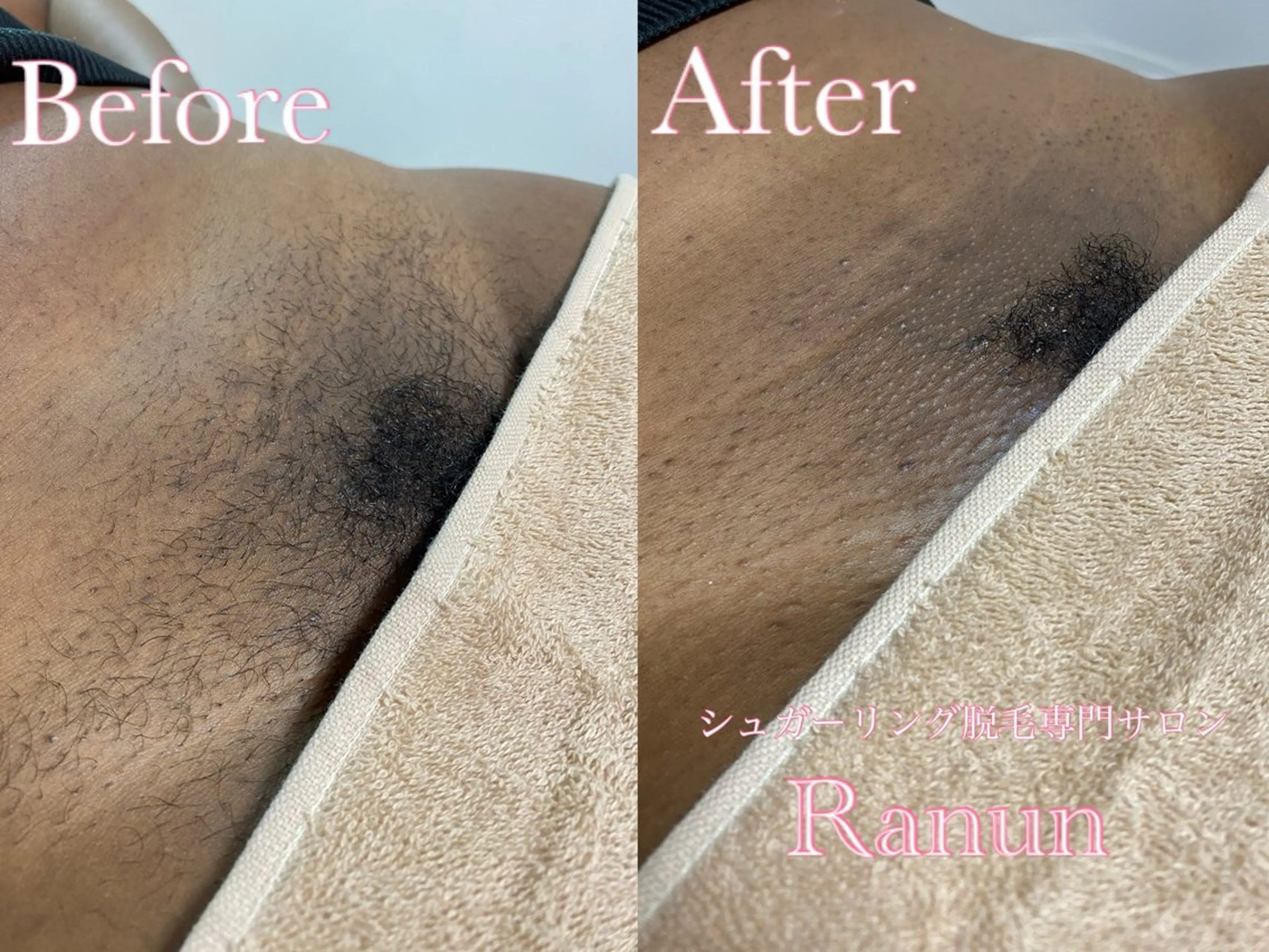 マツエク・マツパ シュガーリング脱毛 専門店Ranunのエステ・リラクイメージ