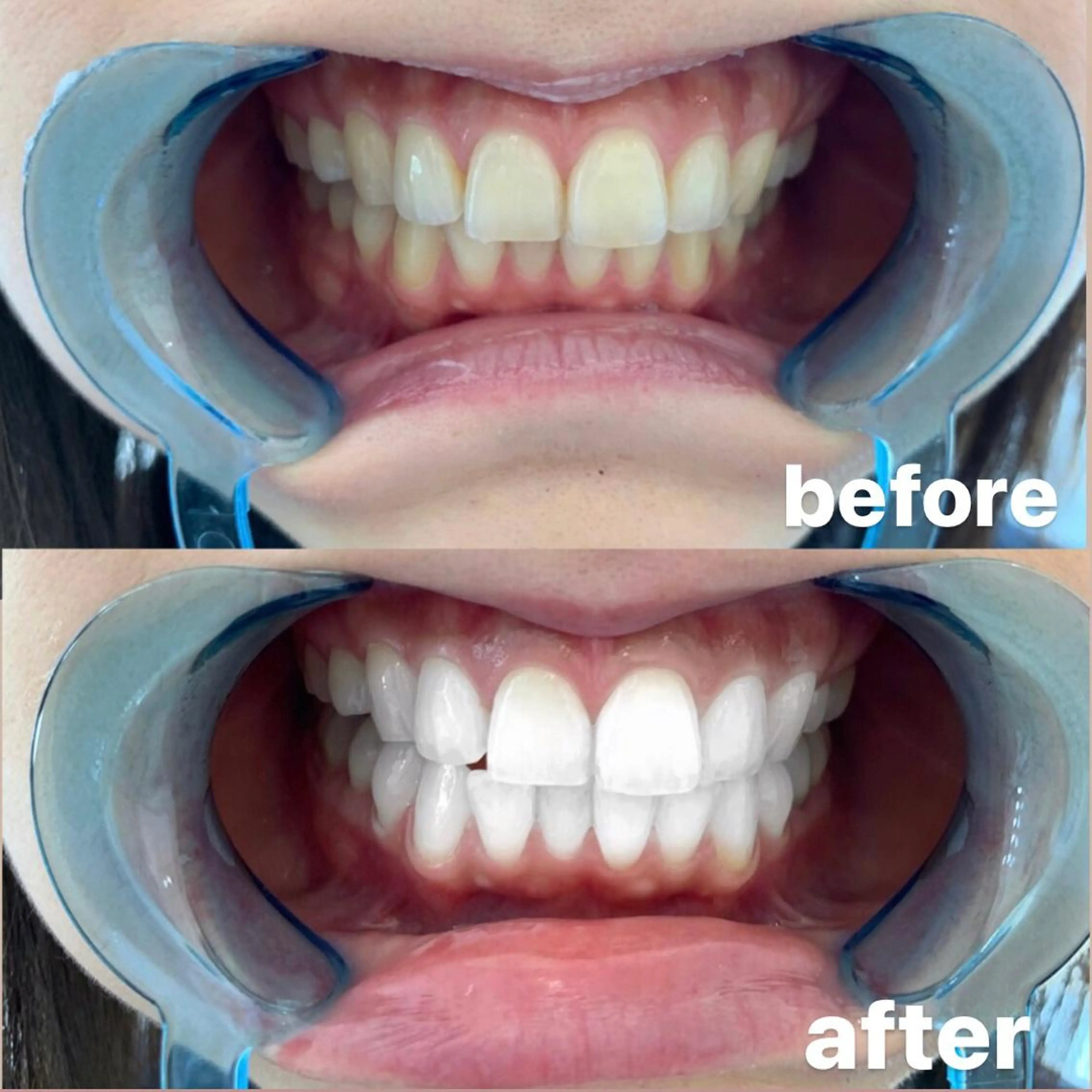 ロング カラー パーマ ヘアアレンジ メンズ キッズ ネイル マツエク・マツパ エステ リラク ライトビューティー 錦糸町店のエステ・リラクイメージ