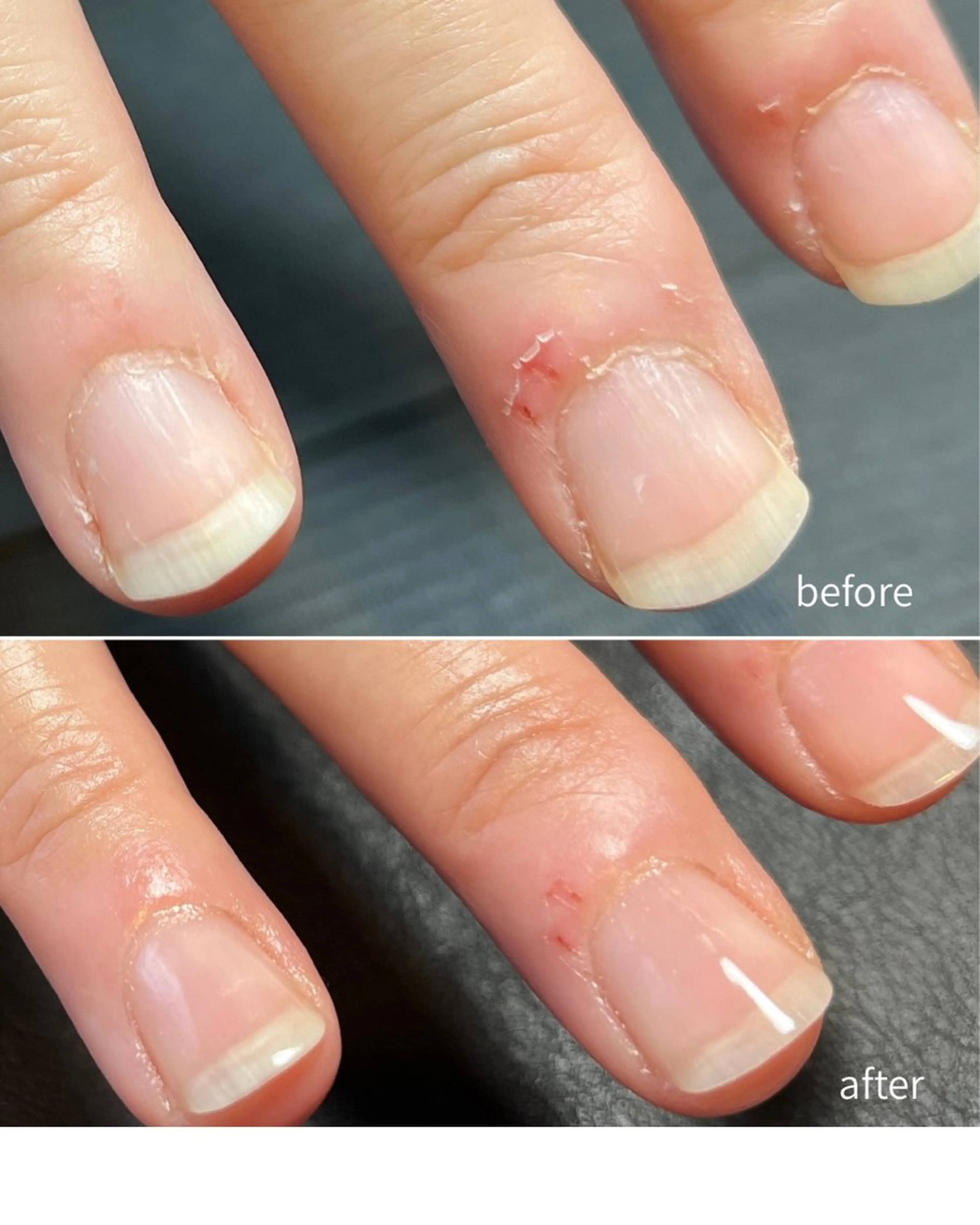 【ジェルをしない方へ】大人のためのハンドケアコース(初回限定)の写真