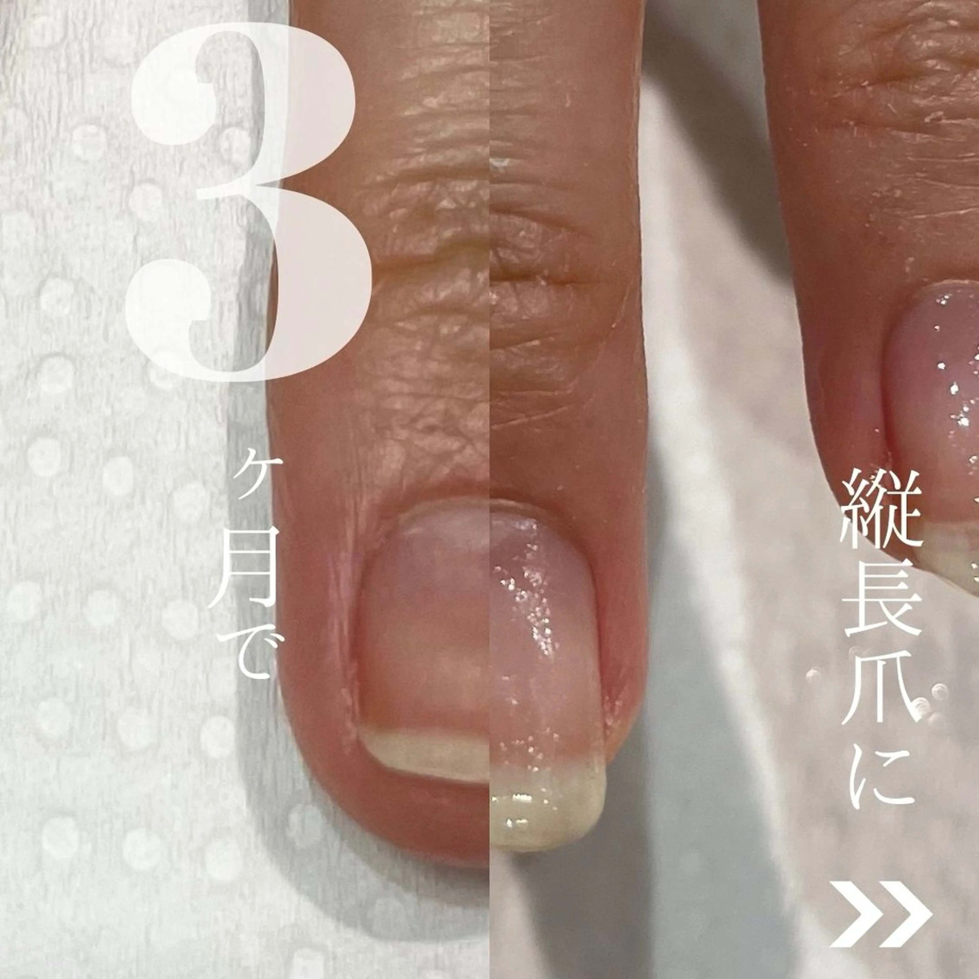 ネイル soa.Aika 自爪育成のネイルデザイン