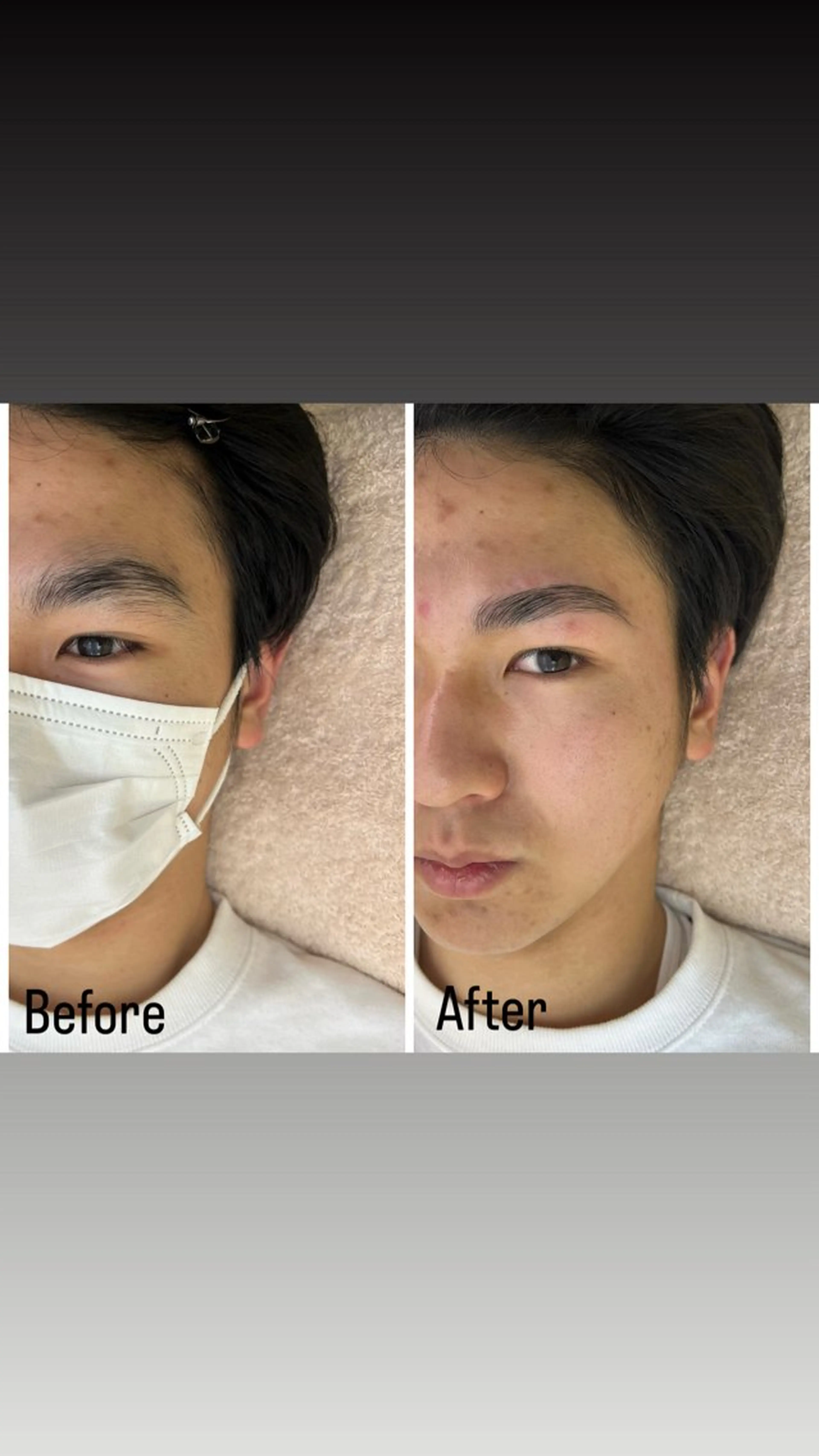 メンズ アイブロウ 眉毛/美肌の専門店 Mily🍒ミウィの眉毛・アイブロウイメージ