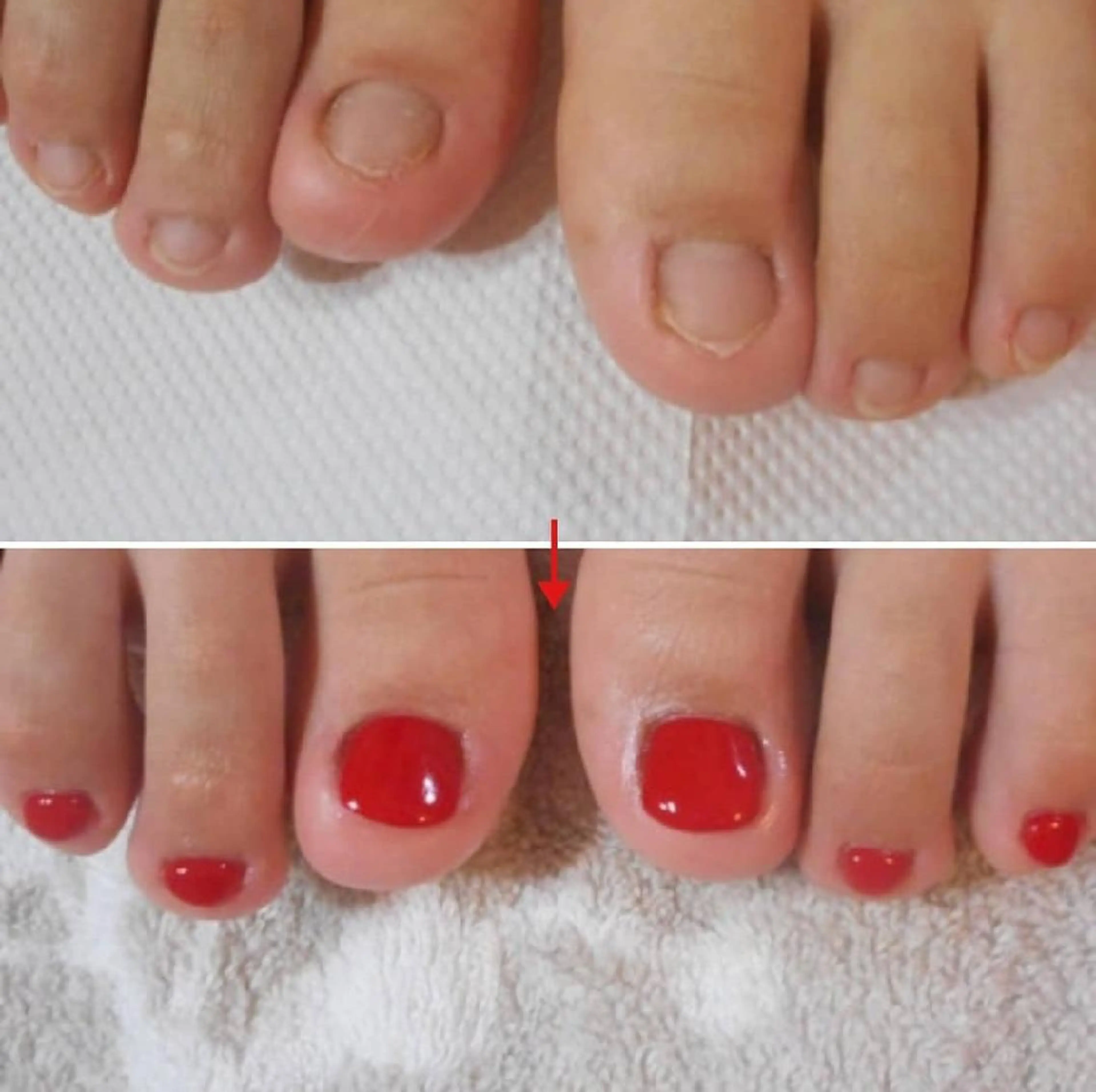 ネイル フットネイル ネイルサロン アリュームのネイルデザイン