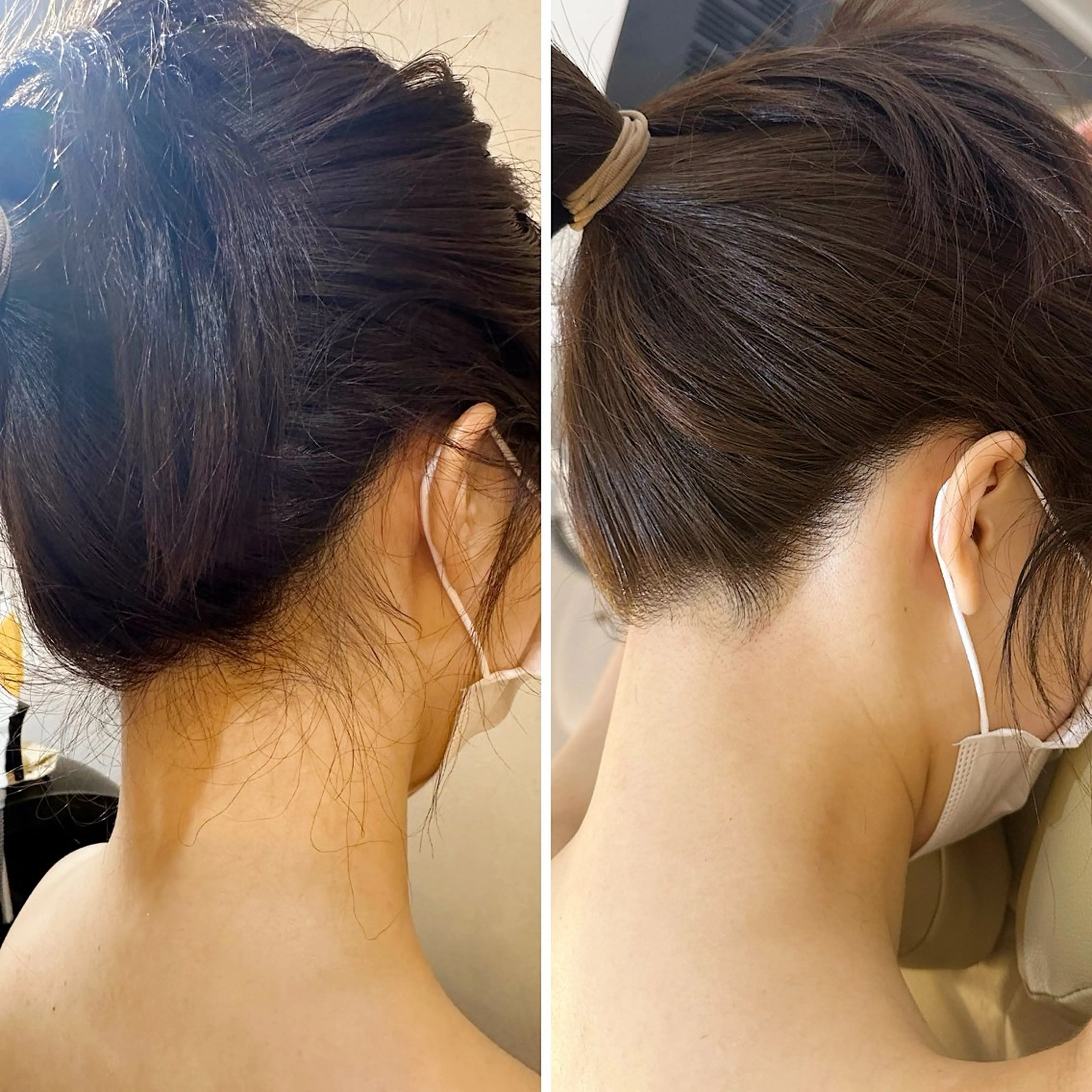 脱毛 うなじ脱毛/美肌脱毛 LABELのエステ・リラクイメージ