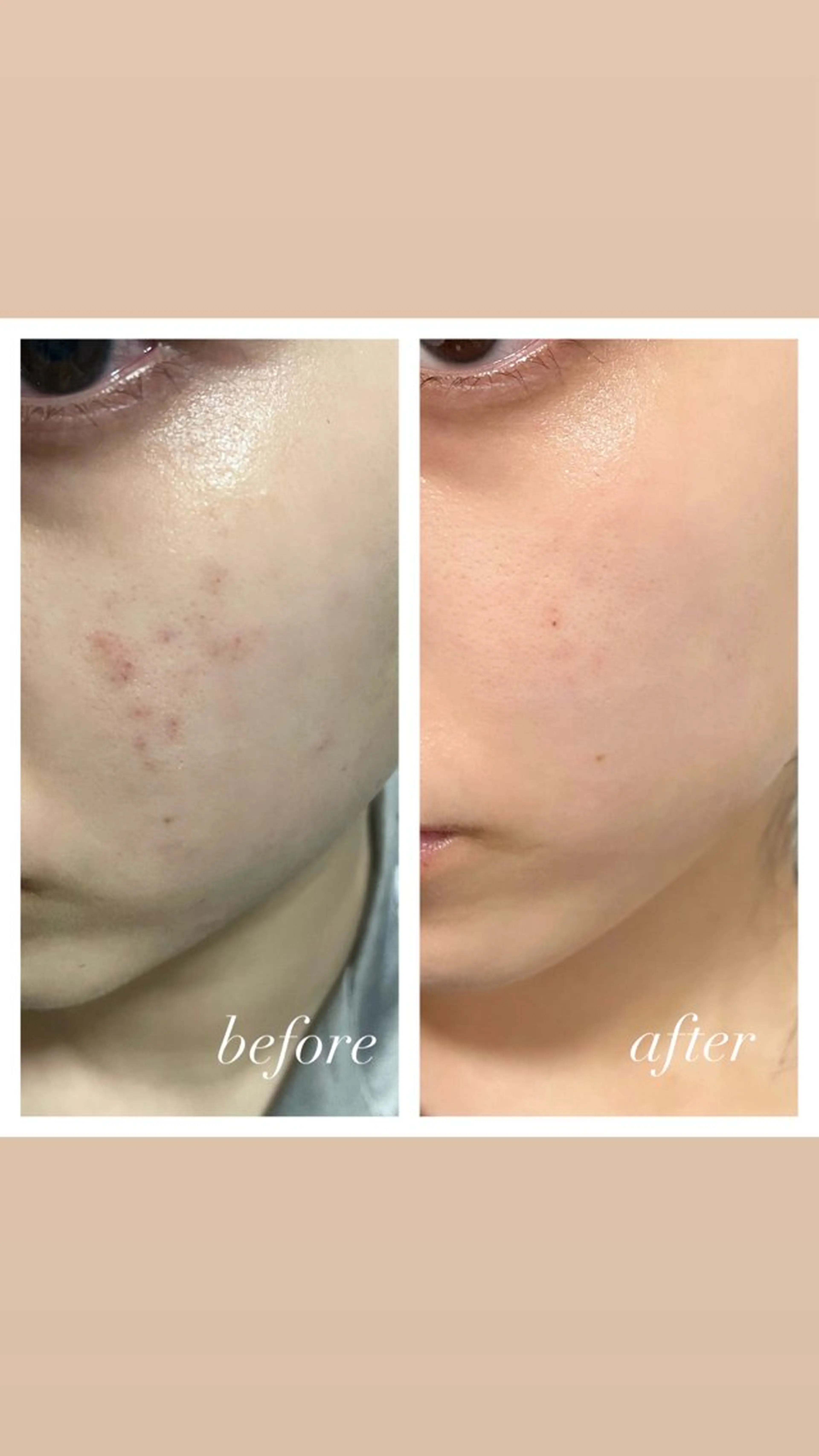 エステ 🦋美肌サロン. maho🦋のエステ・リラクイメージ