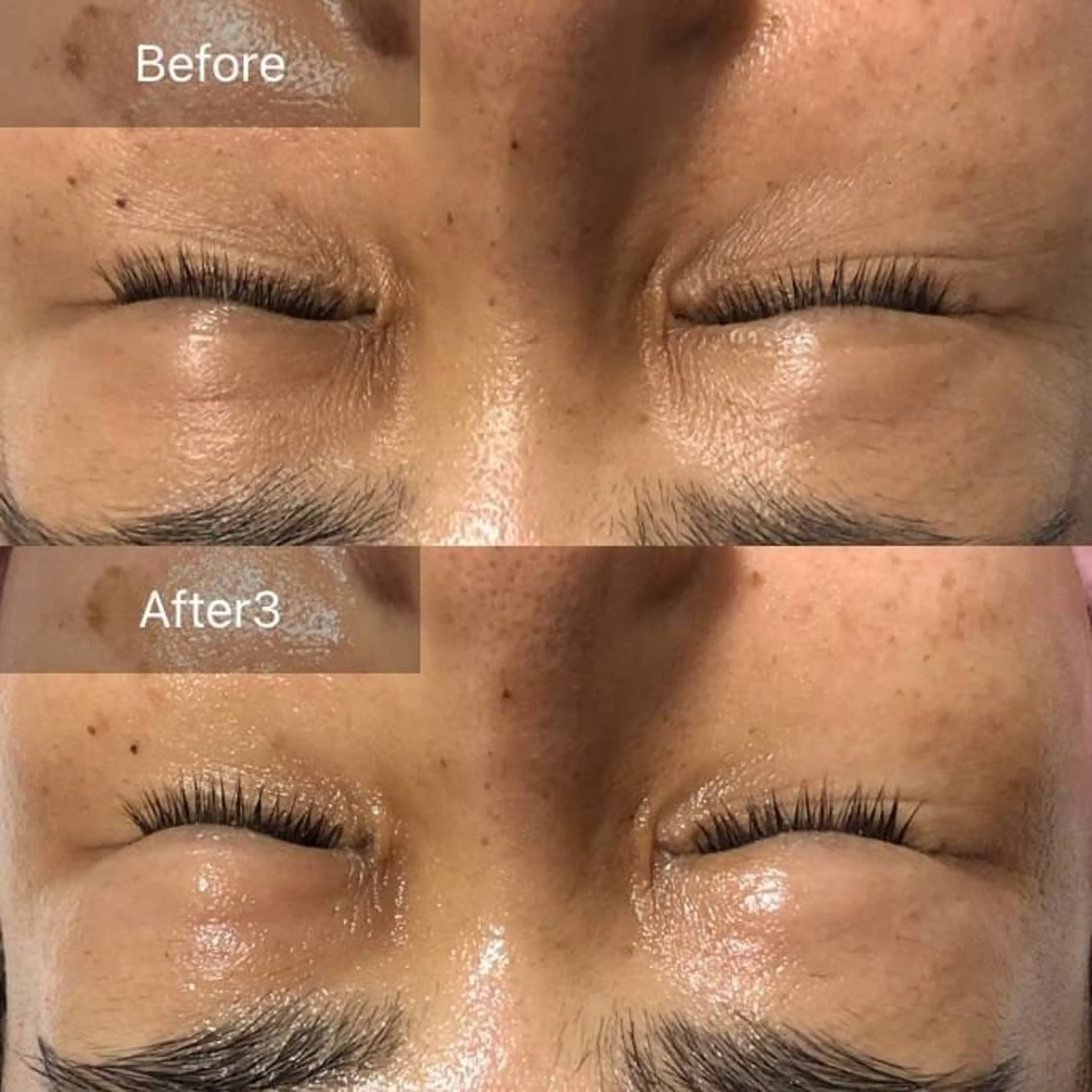 エステ 齋藤 祐里耶のエステ・リラクイメージ