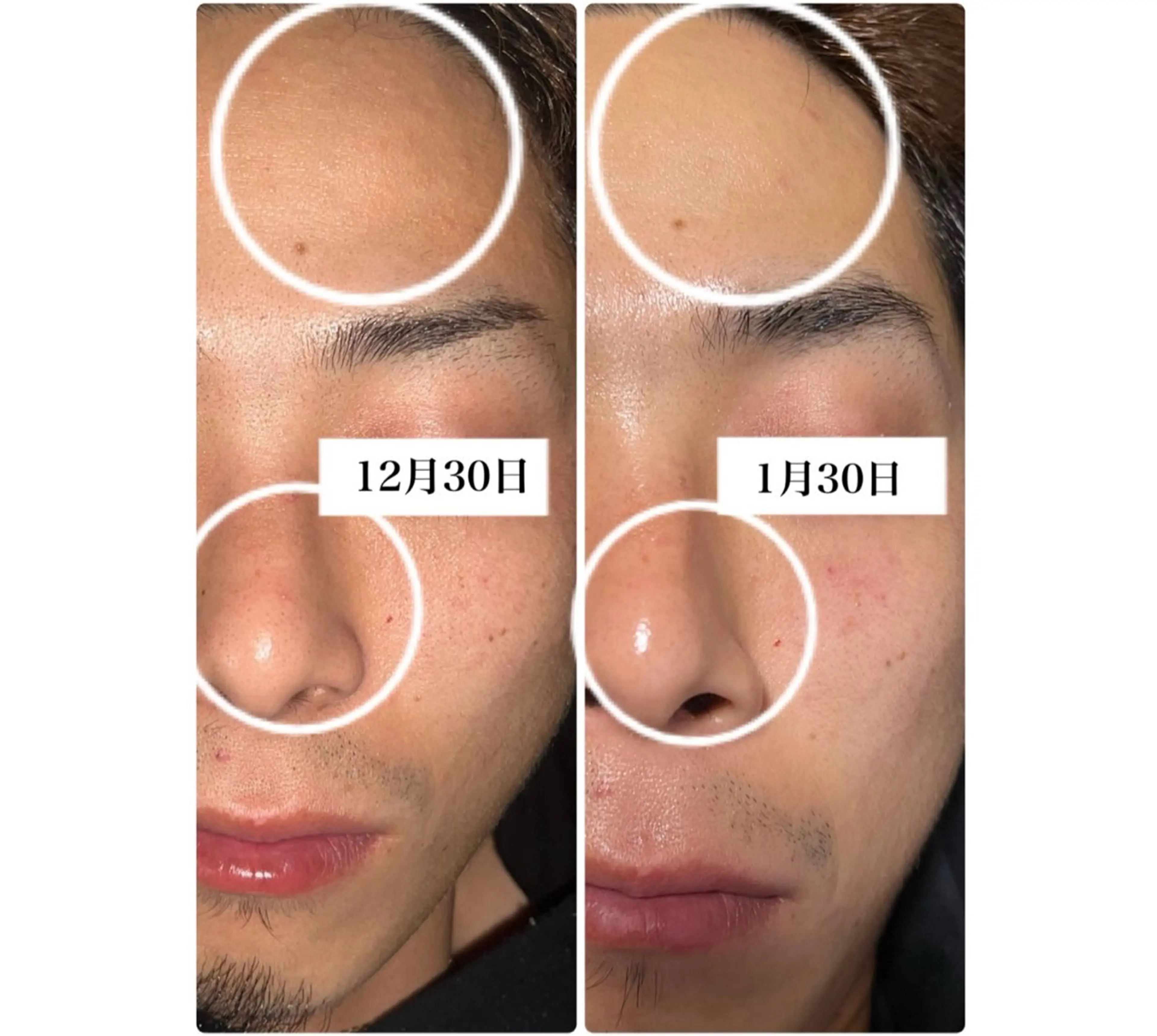 エステ ROR Akariのエステ・リラクイメージ