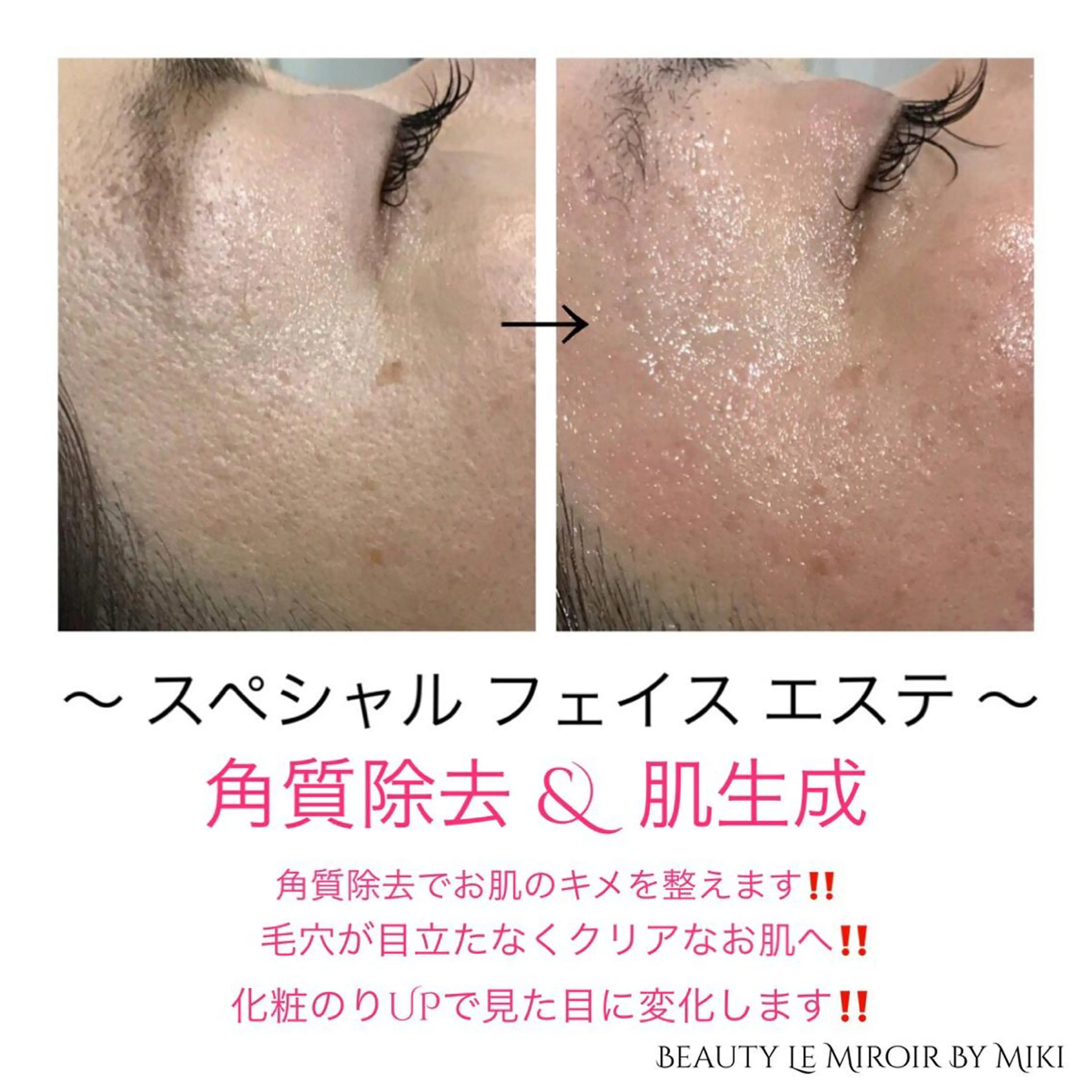 ビューティー ミロワールのエステ・リラクイメージ