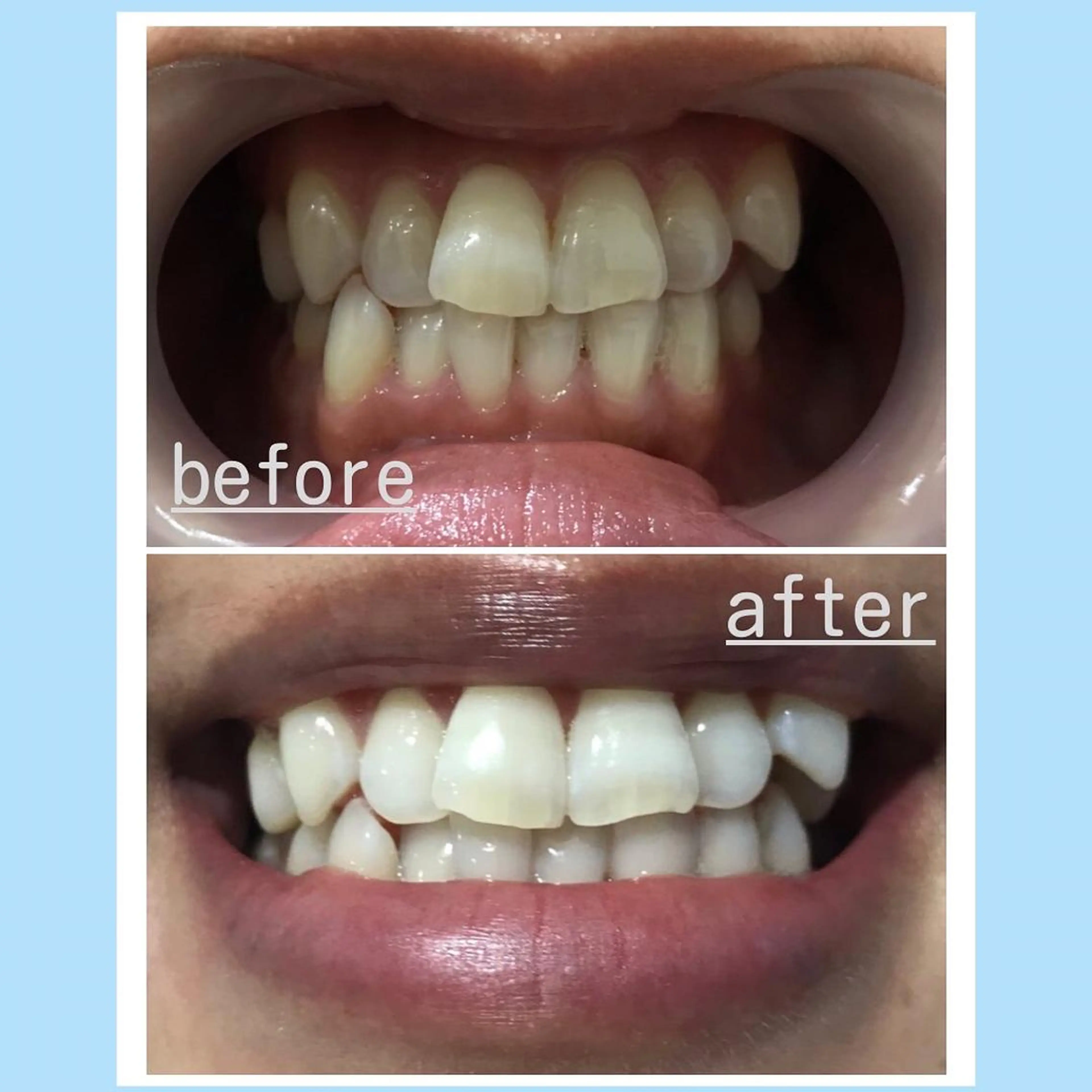 その他 武元 奈津美のその他イメージ