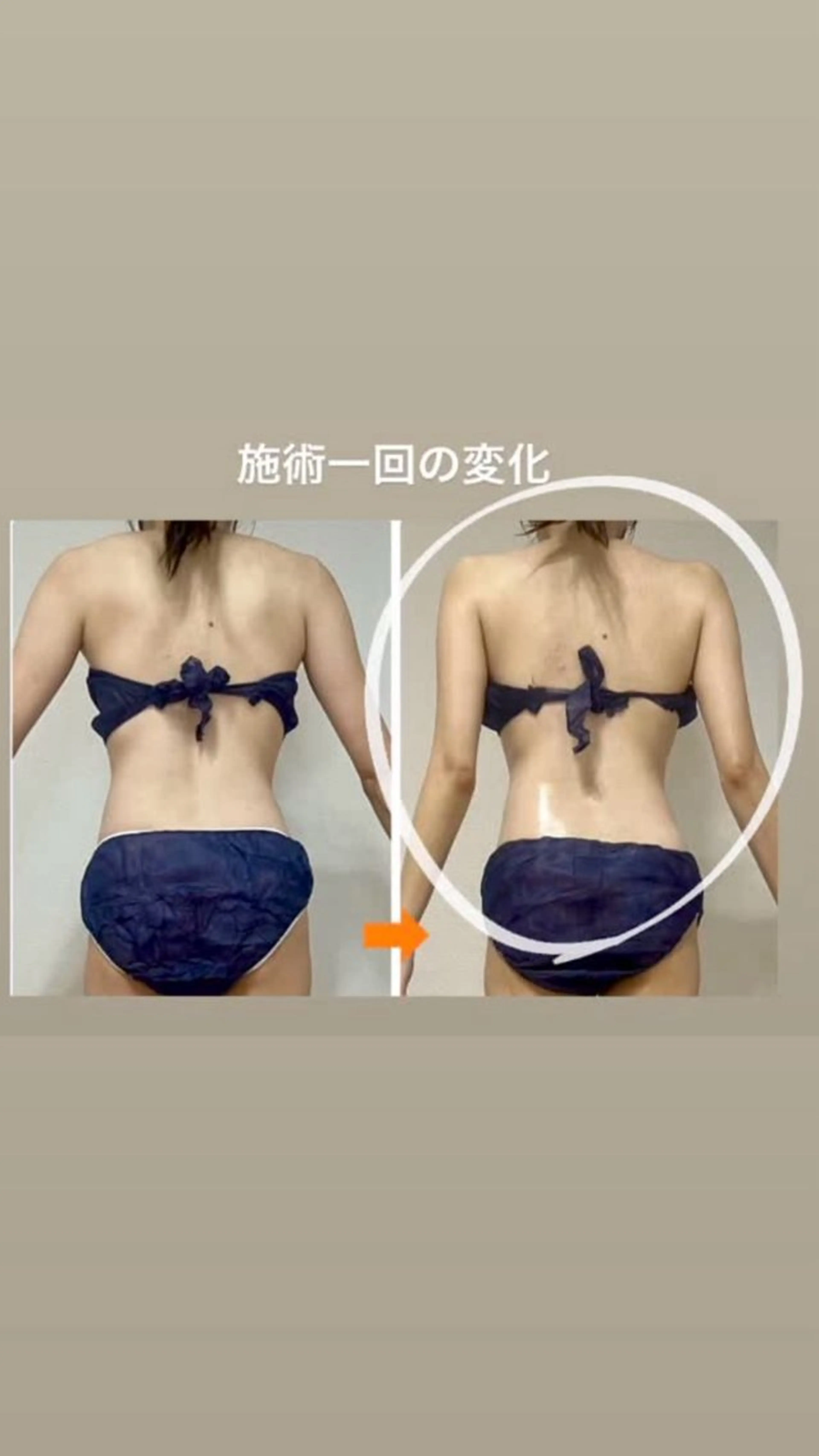 エステ リラク ‍痩身＆ボディ 結果出し🌟丹野のエステ・リラクイメージ