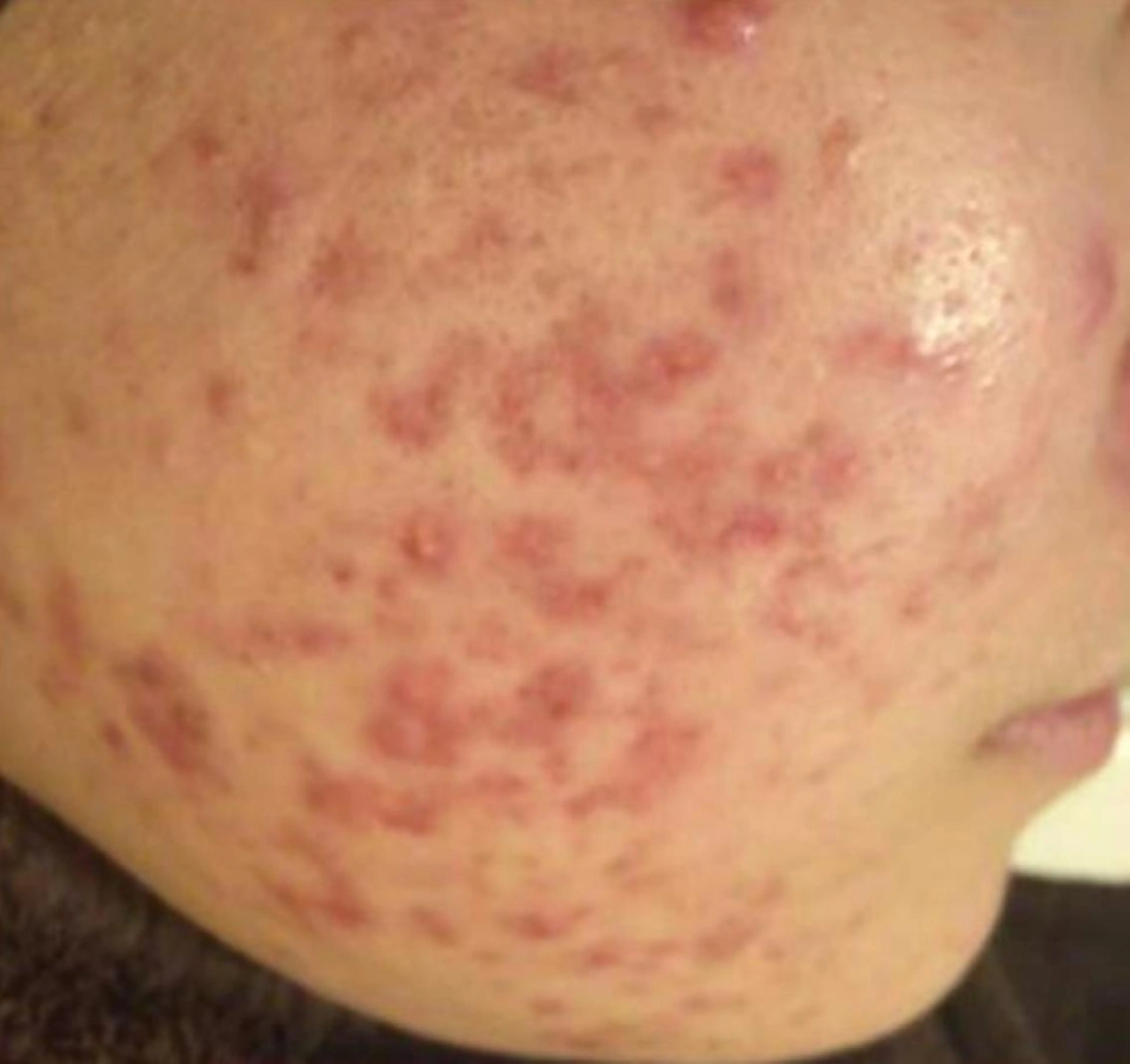 ニキビ経験者が施術 する専門サロン🌻のエステ・リラクイメージ