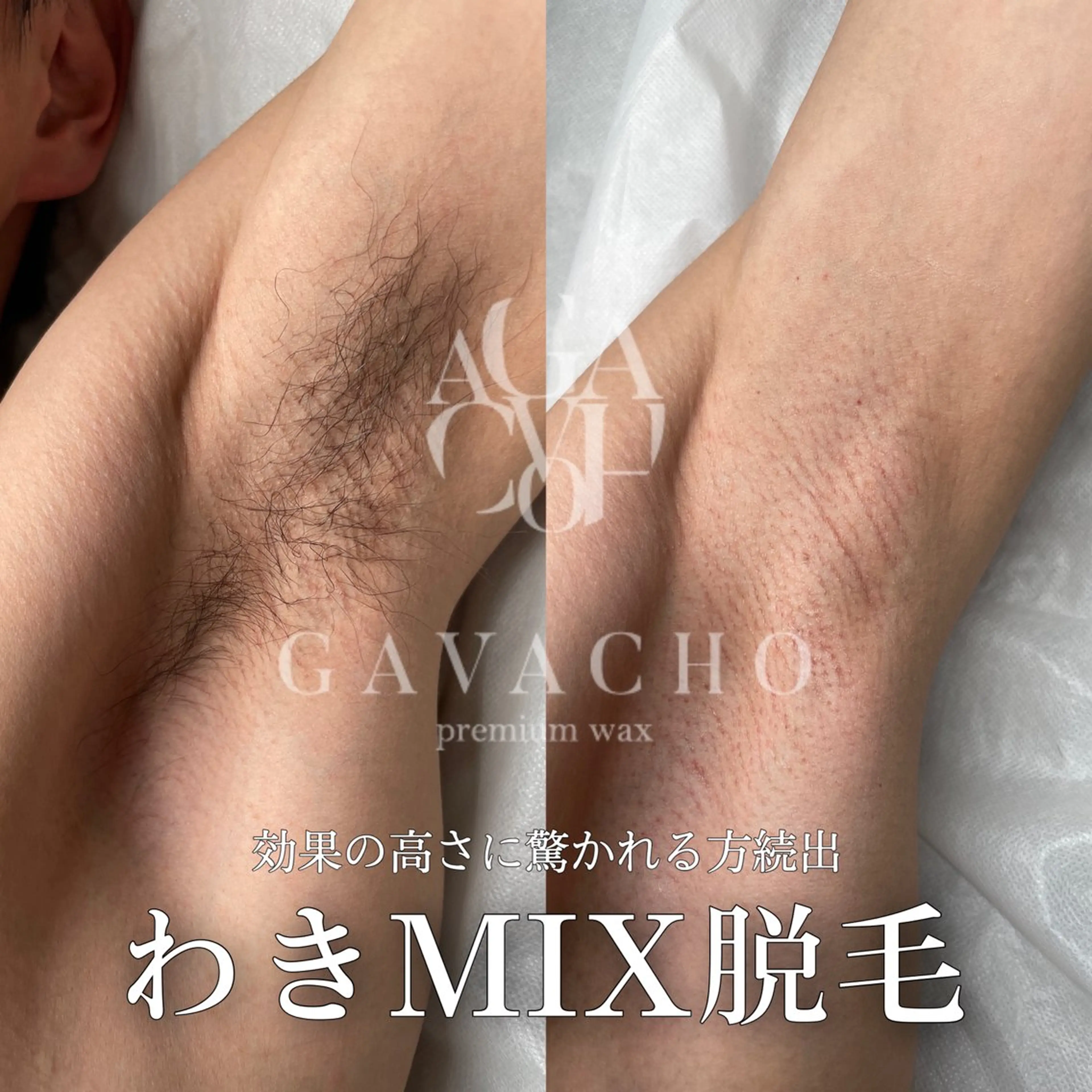 mimi 広島 安佐南区まつ毛・脱毛のマツエク・マツパデザイン