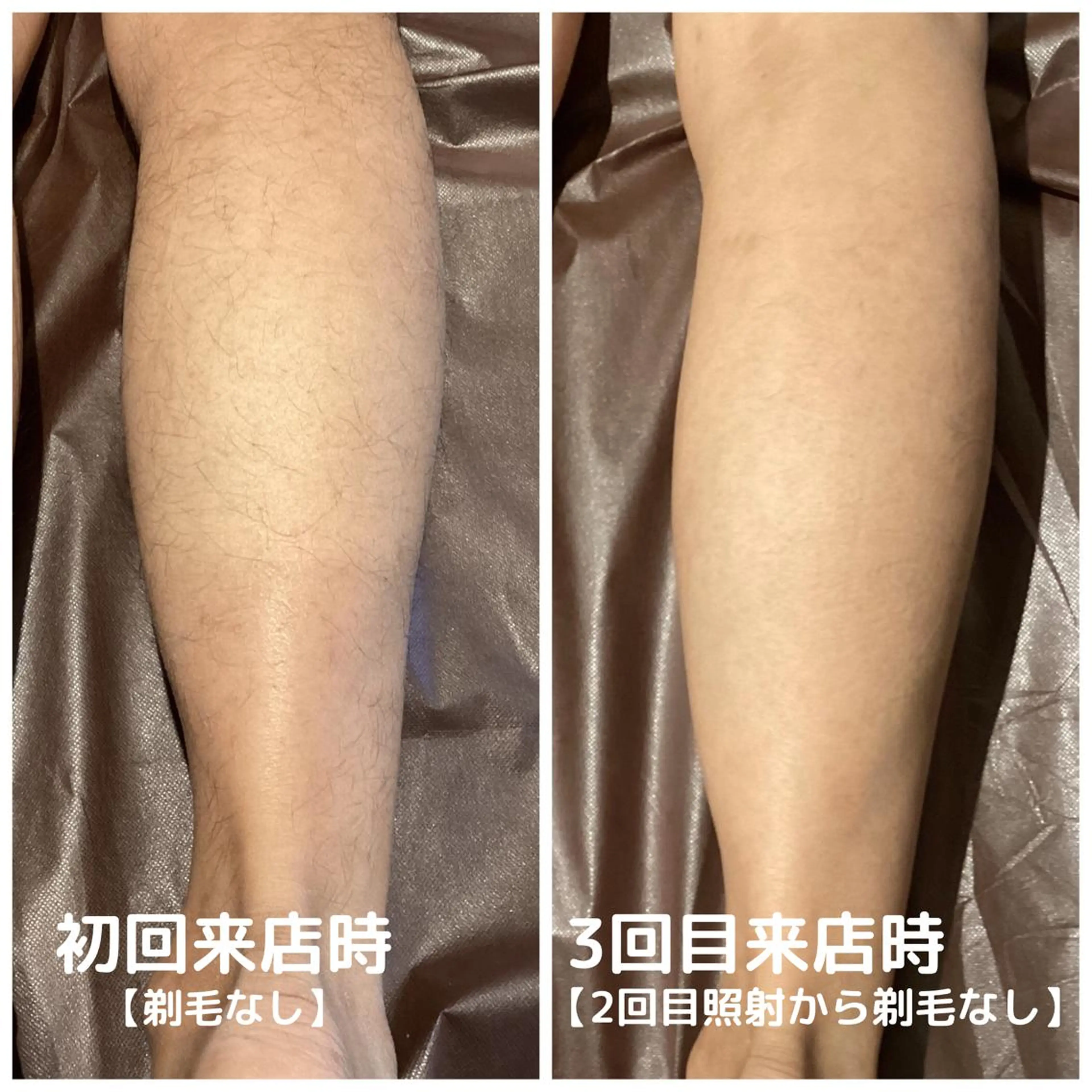 メンズ men's脱毛サロン ECXIAのエステ・リラクイメージ