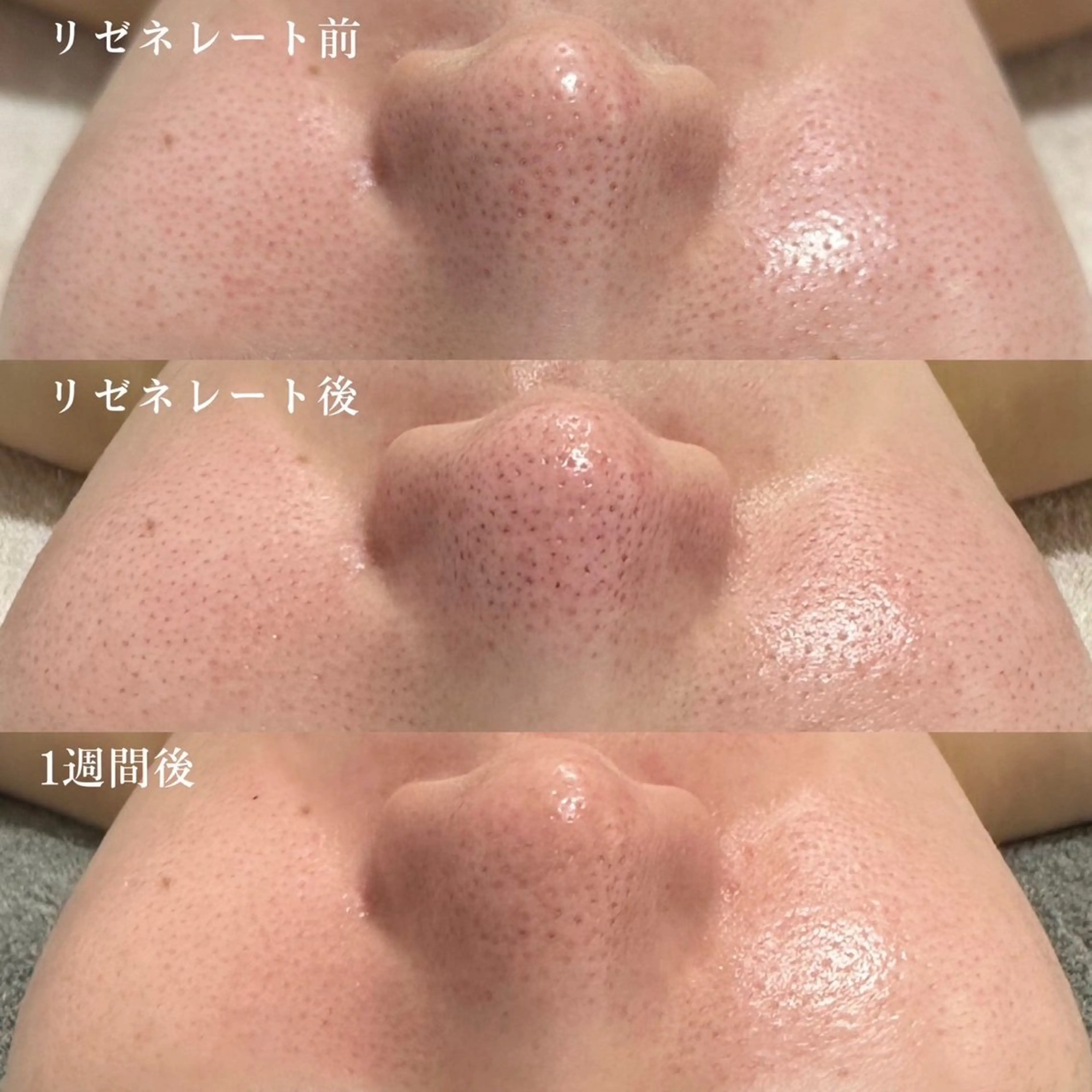 その他 エレファンテブランコ RIOのその他イメージ