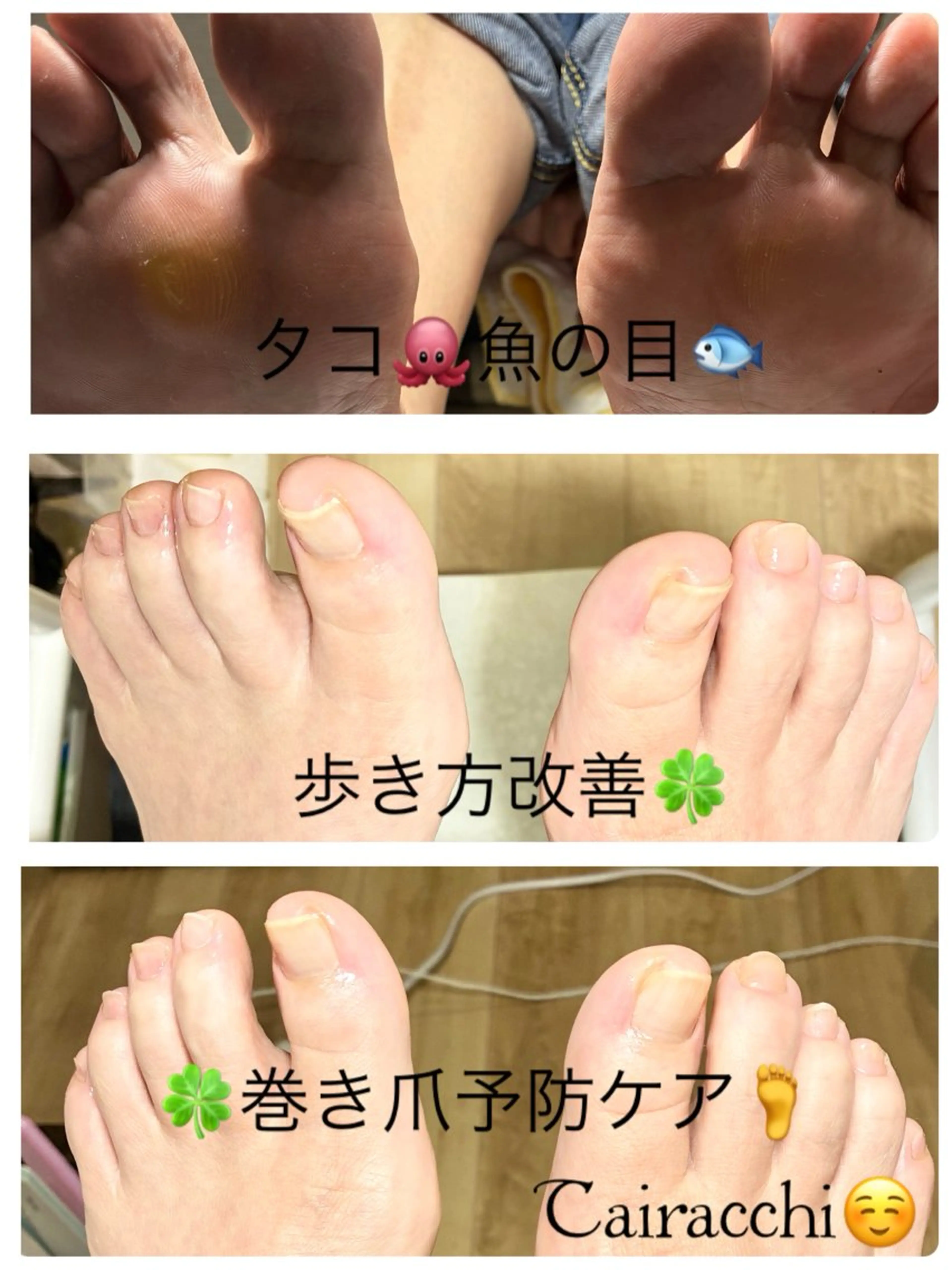 ネイル フットネイル フットネイル Tairacchi ﾀｲﾗｯﾁのエステ・リラクイメージ