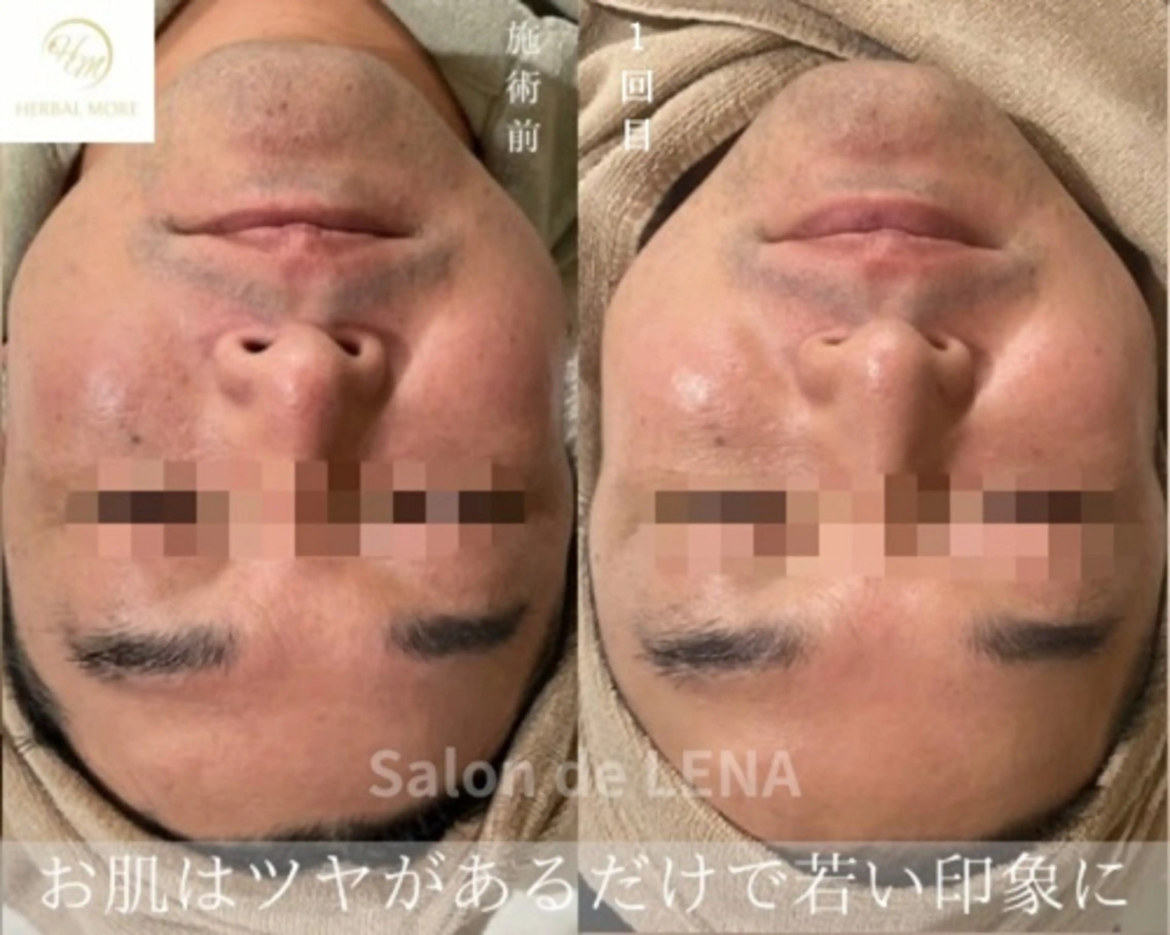 ハーブピーリング・毛穴ケア専門サロンSalon de LENA 栄店所属・ハーブピーリング専門 サロンドレナ　白藤のエステ・リラクイメージ