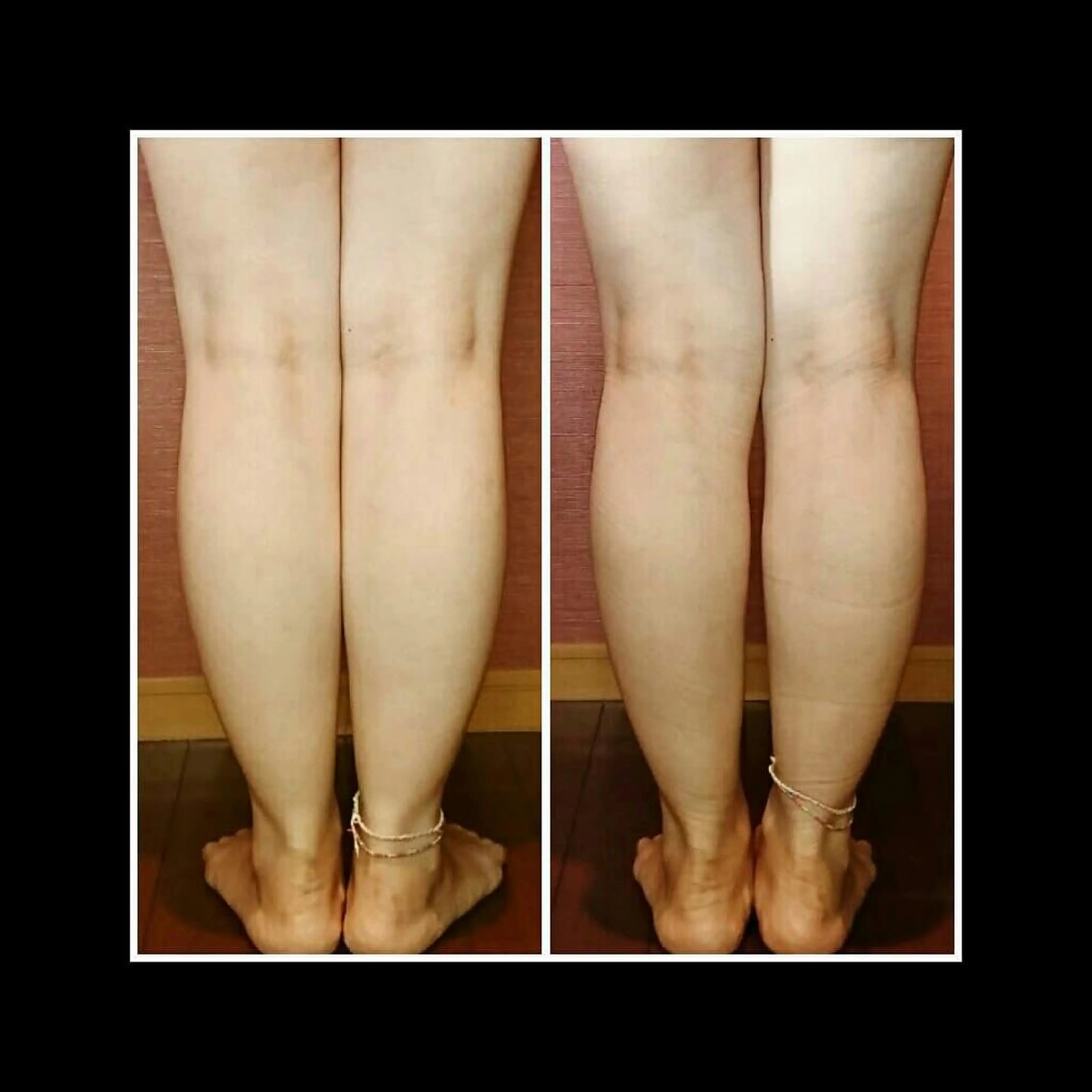 エステ リラク Nako  ﾅｺのエステ・リラクイメージ