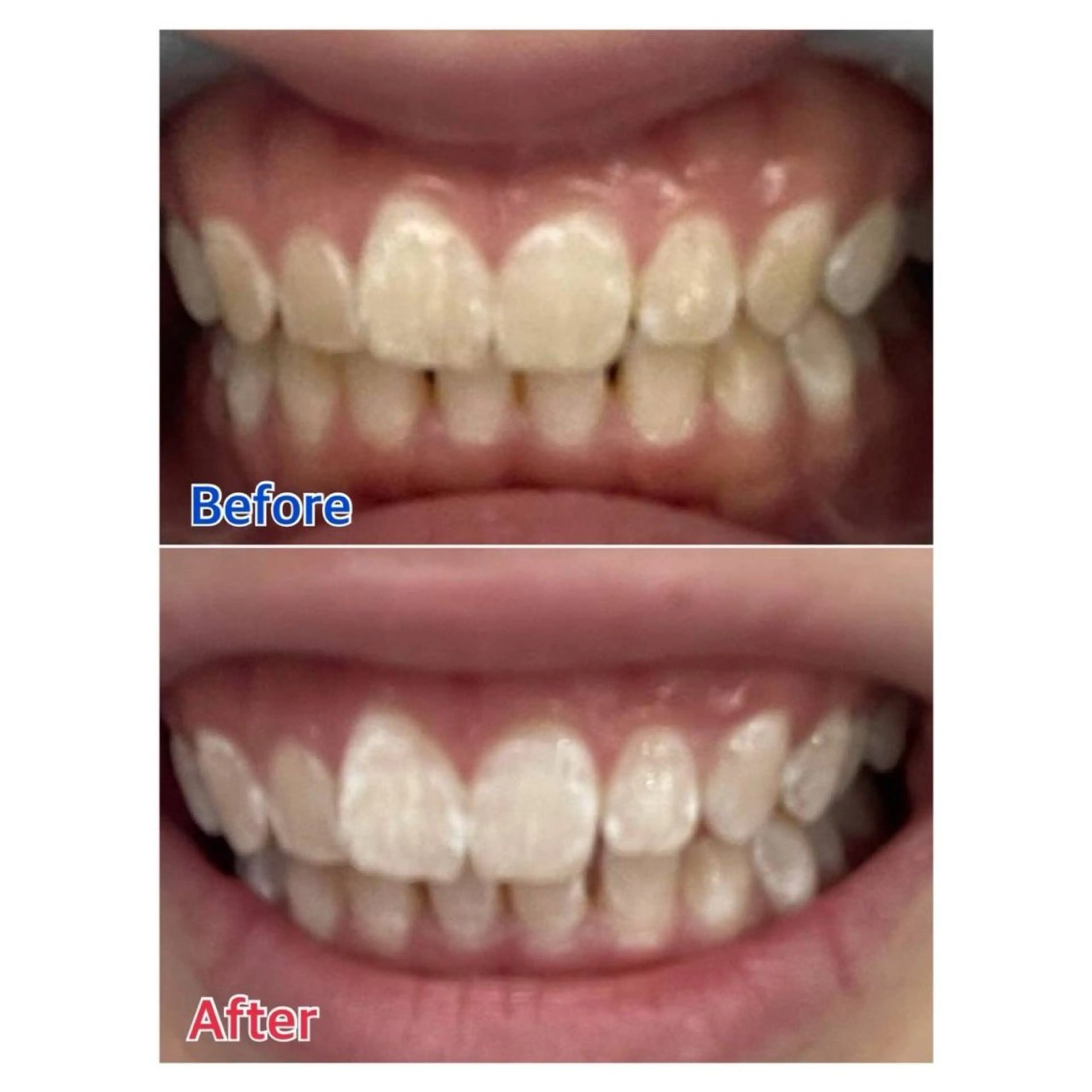 Melty 輝のその他イメージ