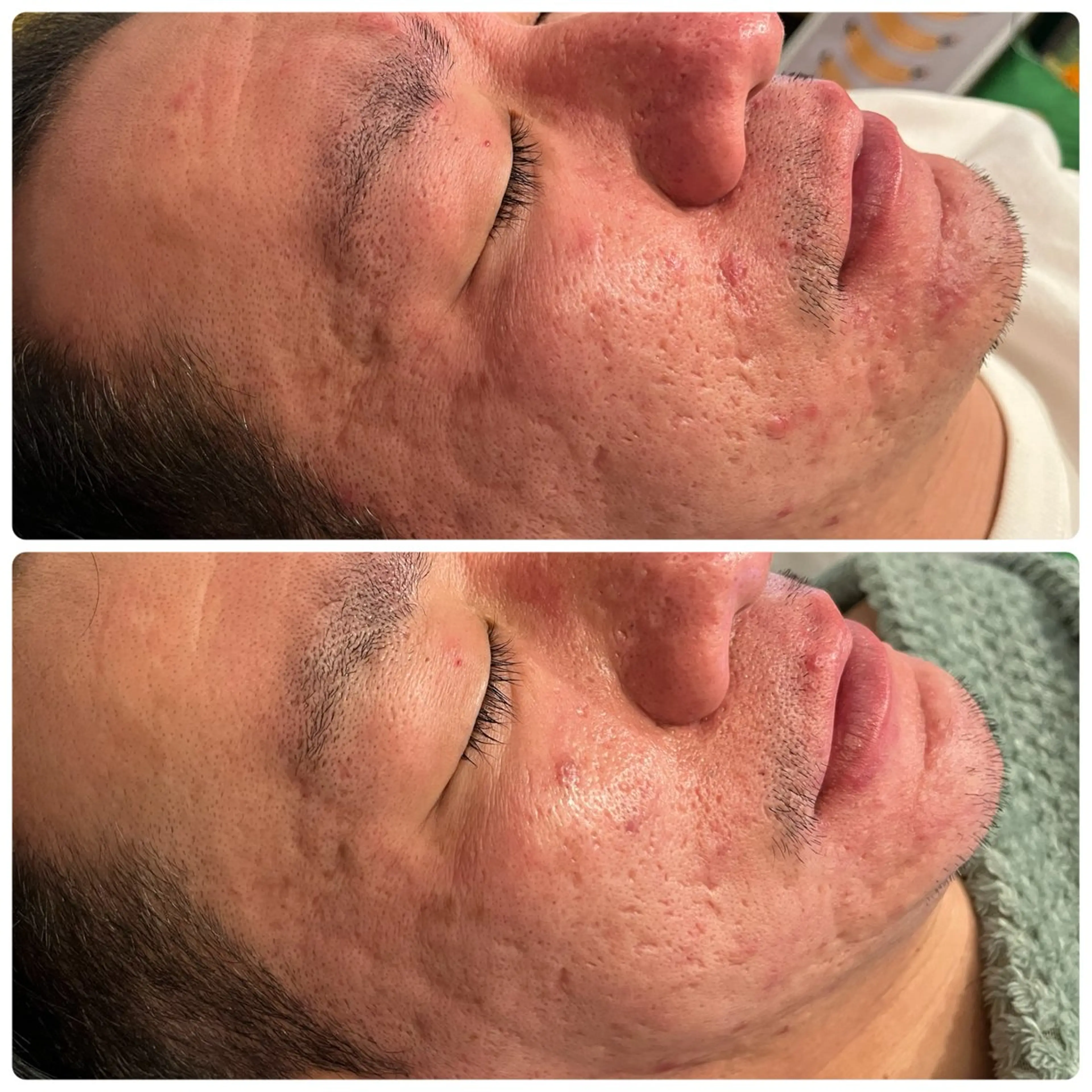 脱毛 yellow💛【 脱毛&フェイシャル】のエステ・リラクイメージ