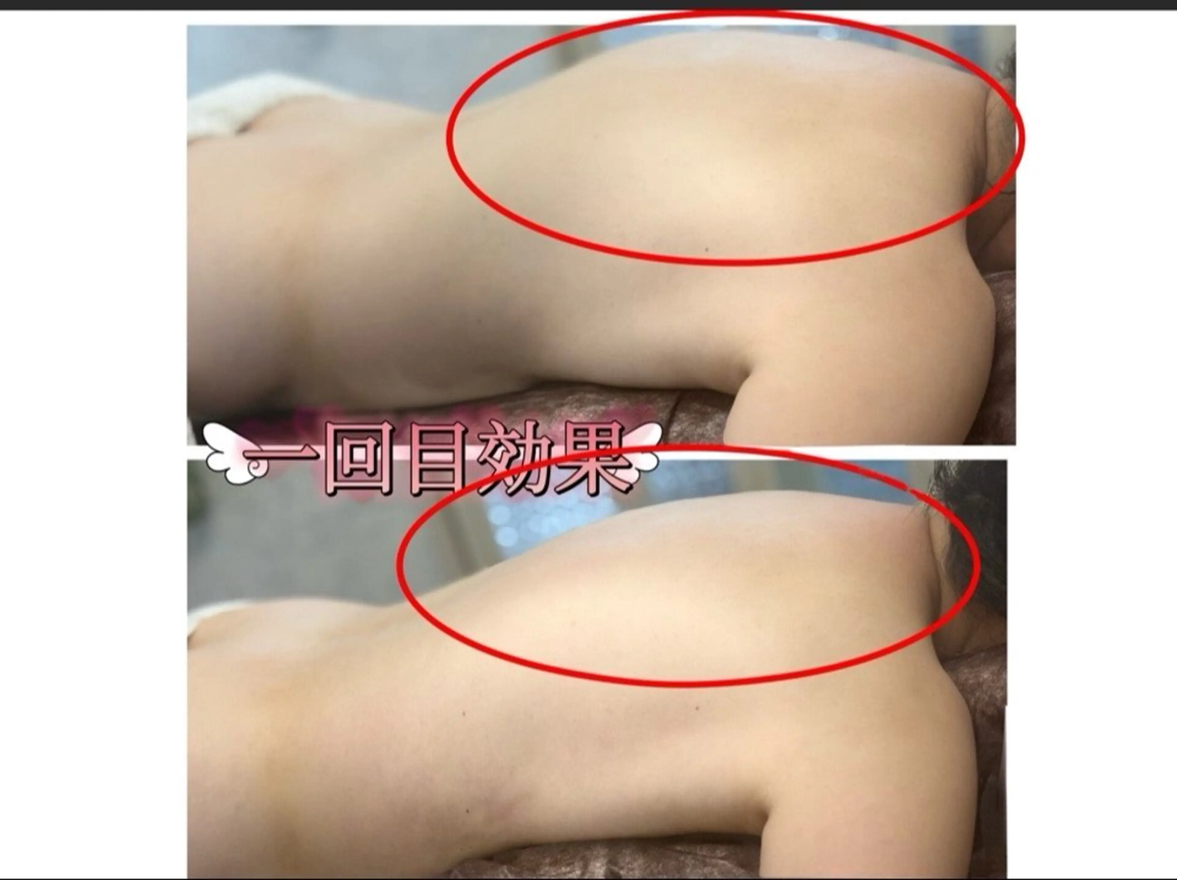 【痩身人気 No.1】痩身+全身アロマリンパマッサージ130分¥12,900の写真