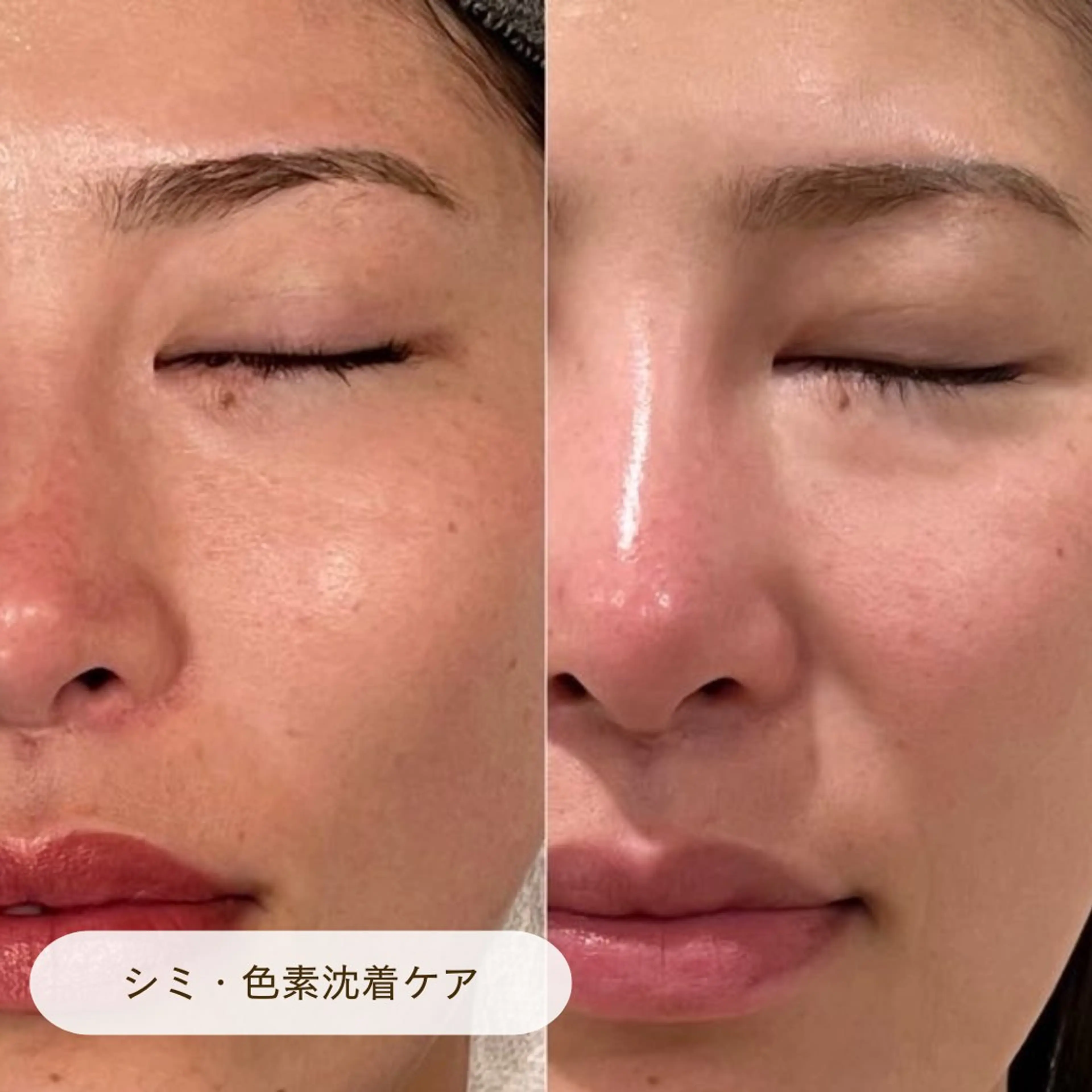 エステ リラク CURATED SKIN｜神戸三宮のエステ・リラクイメージ