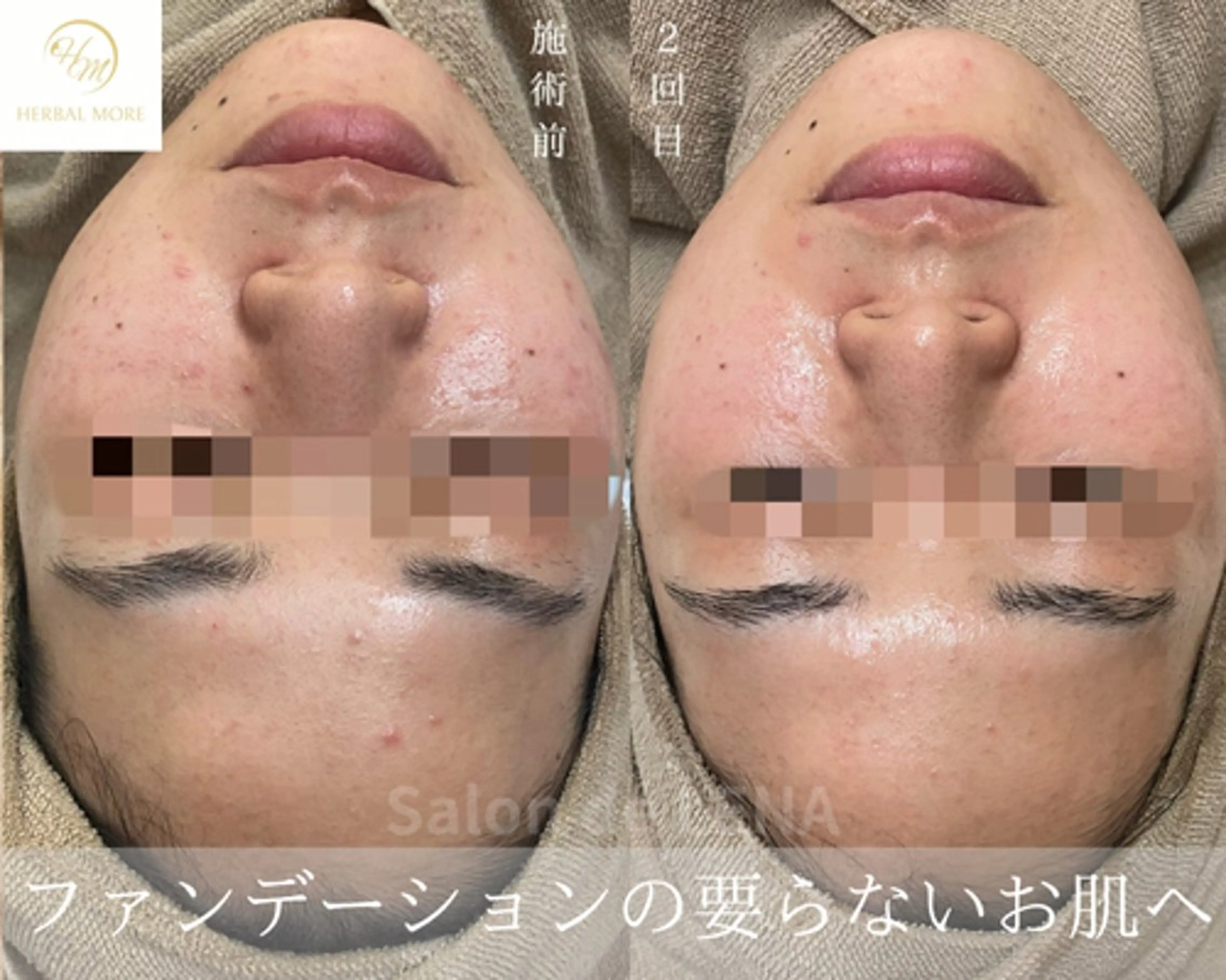 ハーブピーリング専門 サロンドレナ　白藤のエステ・リラクイメージ
