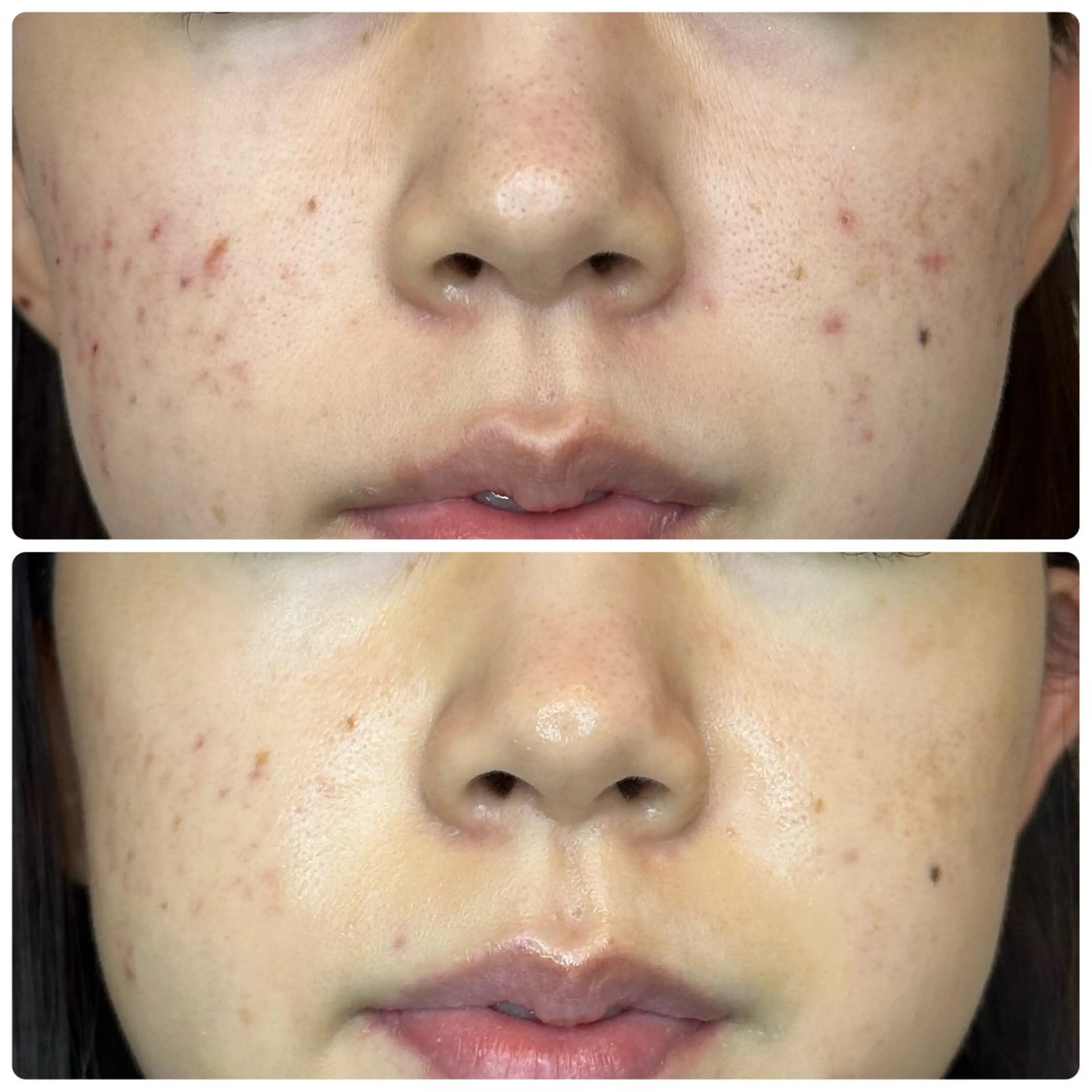 ROUN'　南 鈴沙のネイルデザイン