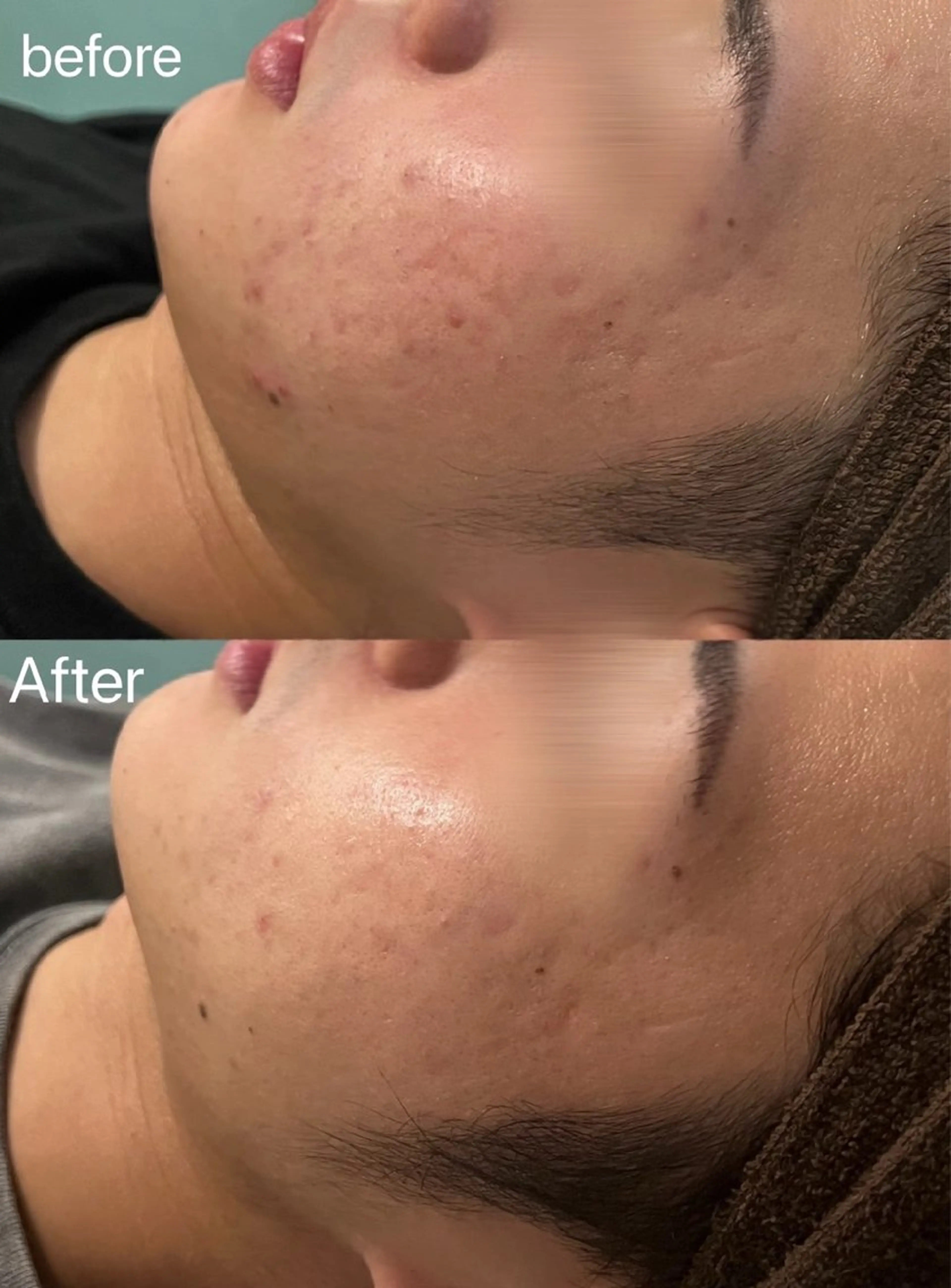 エステ 韓国肌管理 Belleのエステ・リラクイメージ