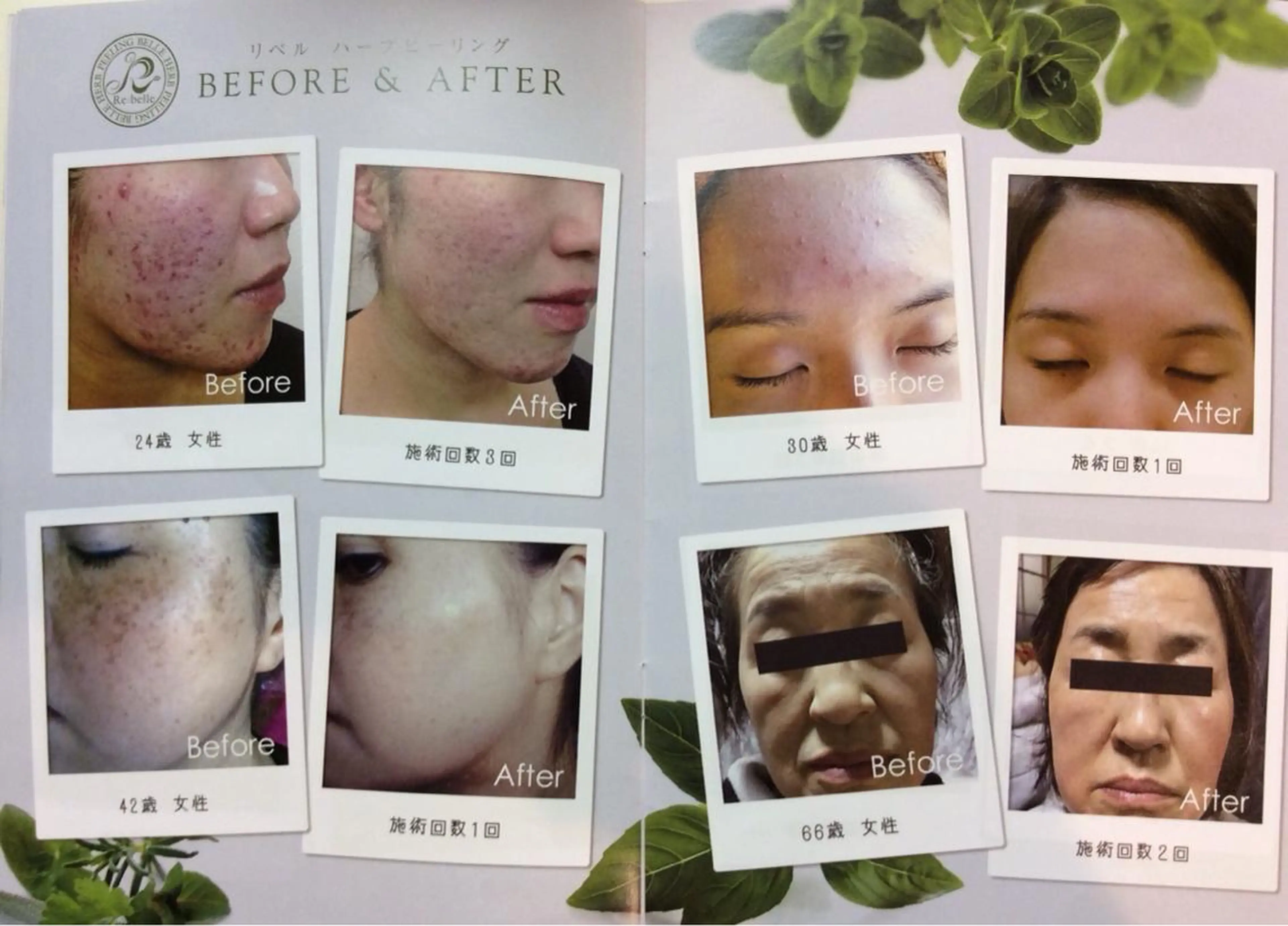 ジョリ   ヴェール 山口のその他イメージ