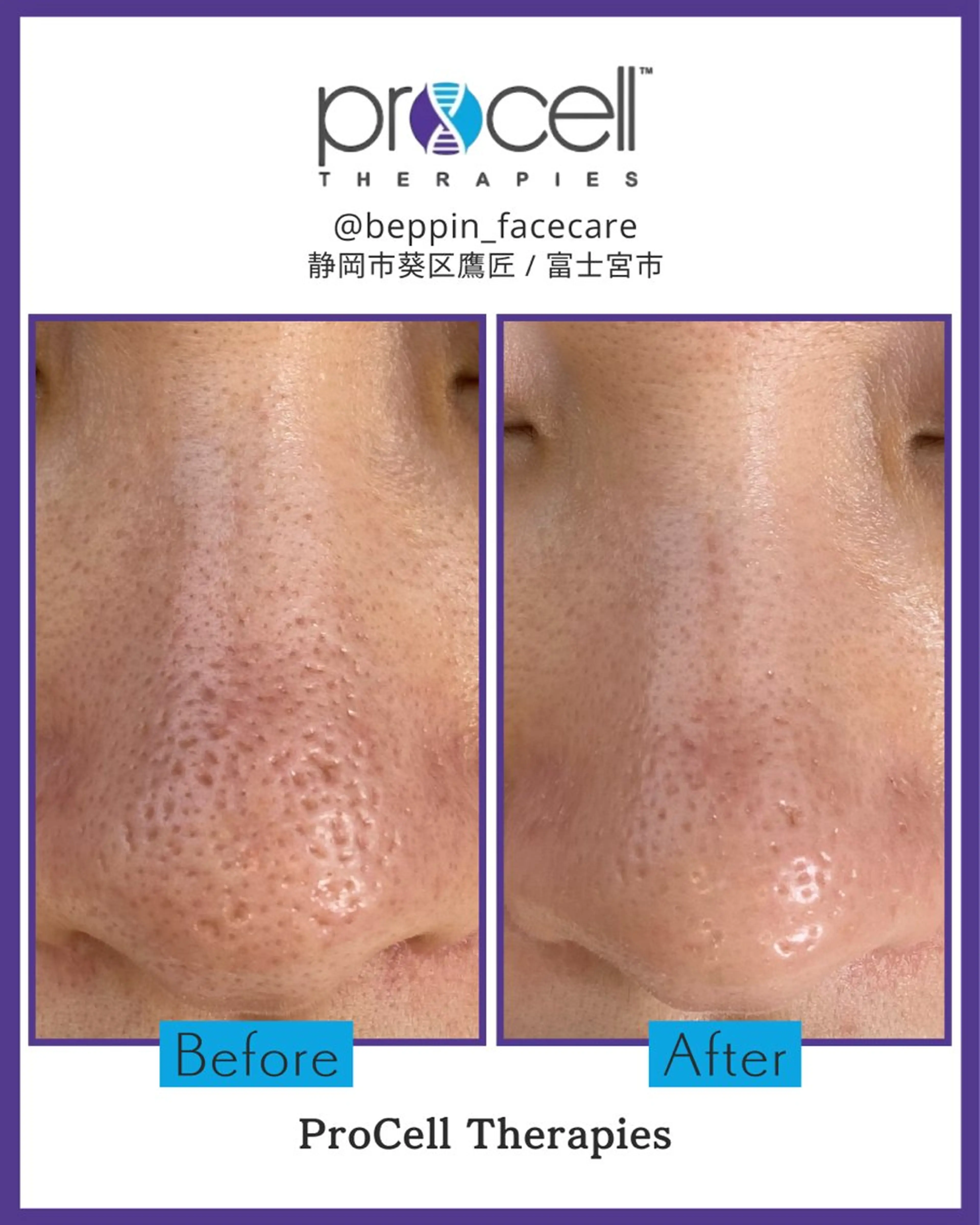 メンズ the 別嬪 静岡店のエステ・リラクイメージ