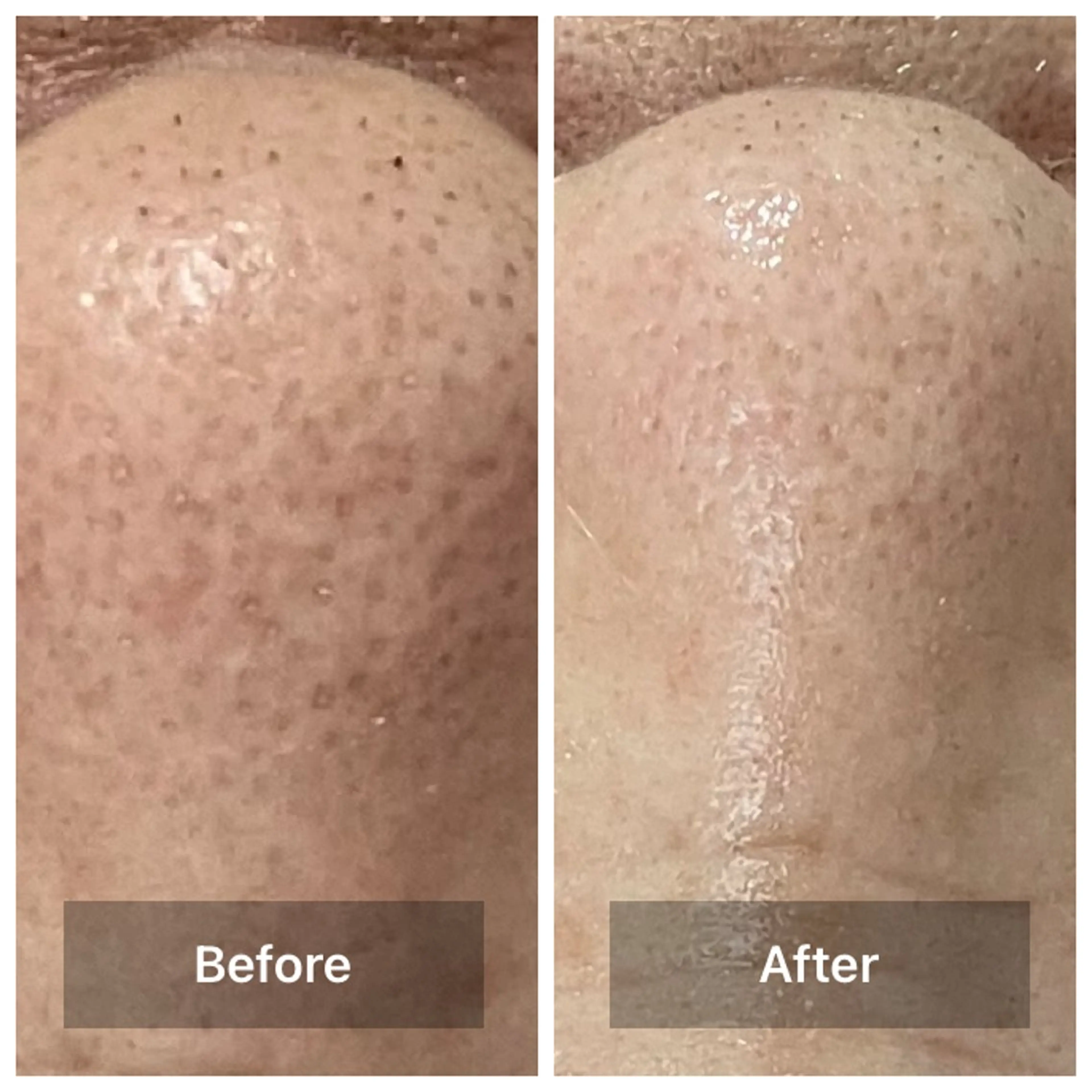 エステ bonuru salonのエステ・リラクイメージ