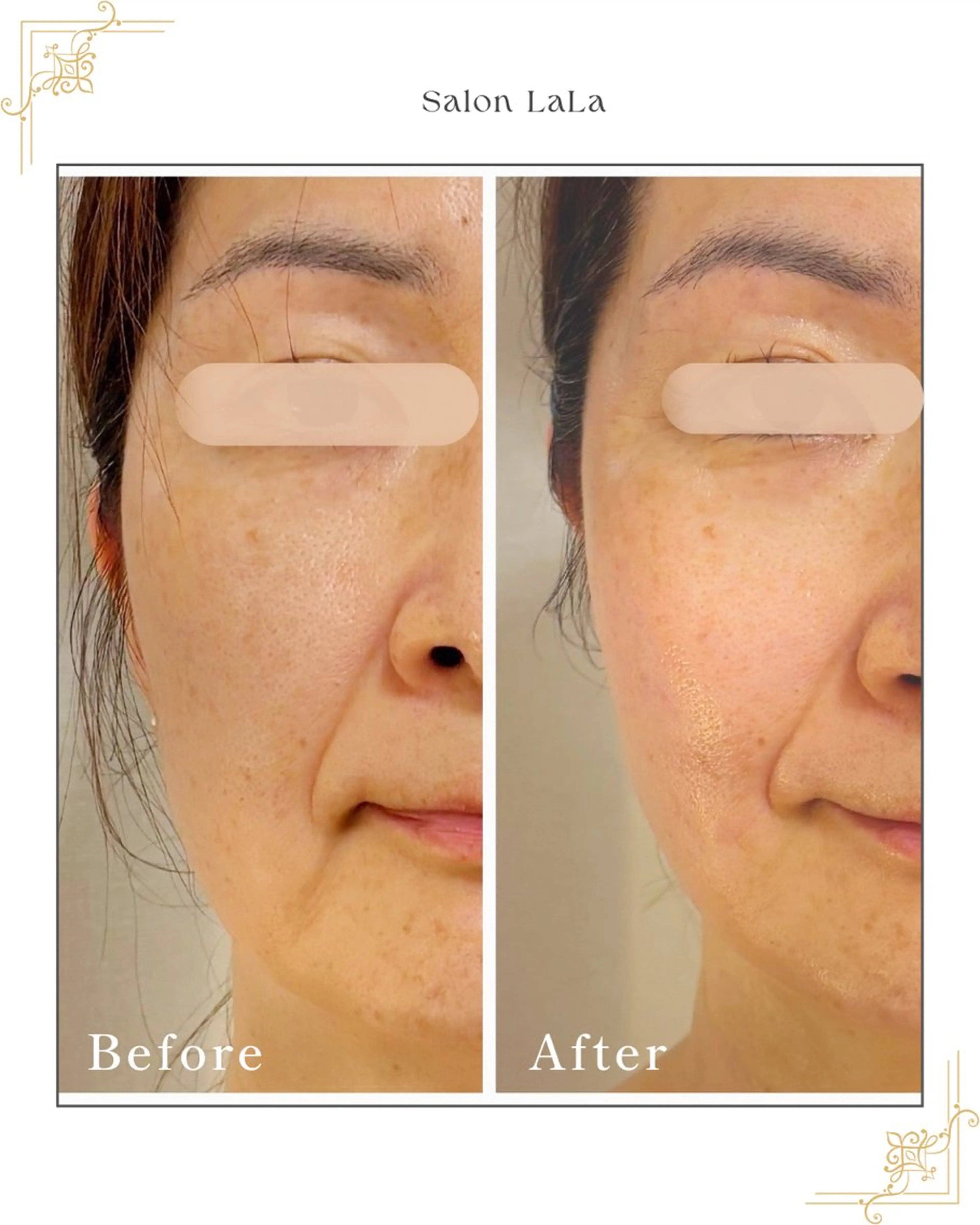 LaLa所属・小顔・たるみケア 専門店【LaLa】のエステ・リラクイメージ