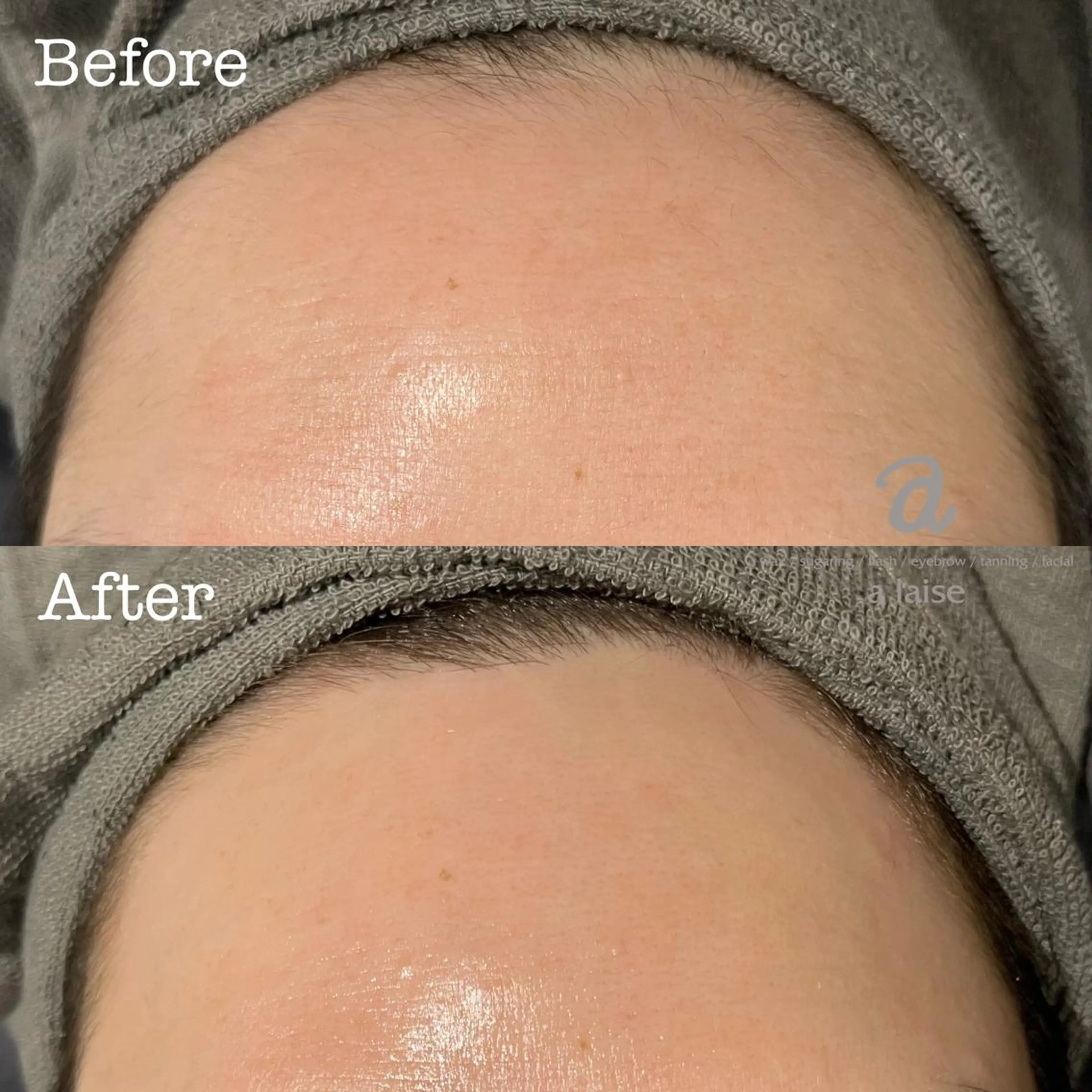 脱毛 a laise 斉藤(表参道)のエステ・リラクイメージ