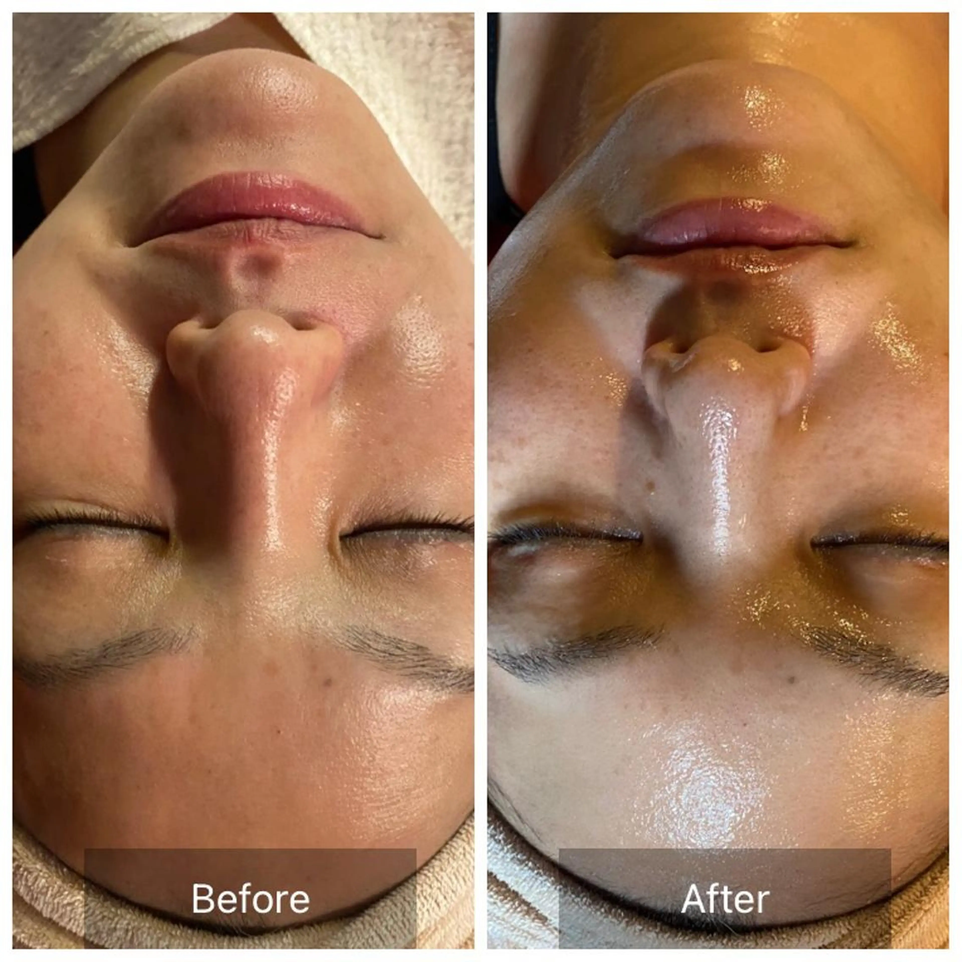 エステ Mandarin Orange所属・毛穴から始める肌メン テマンダリンオレンジのエステ・リラクイメージ