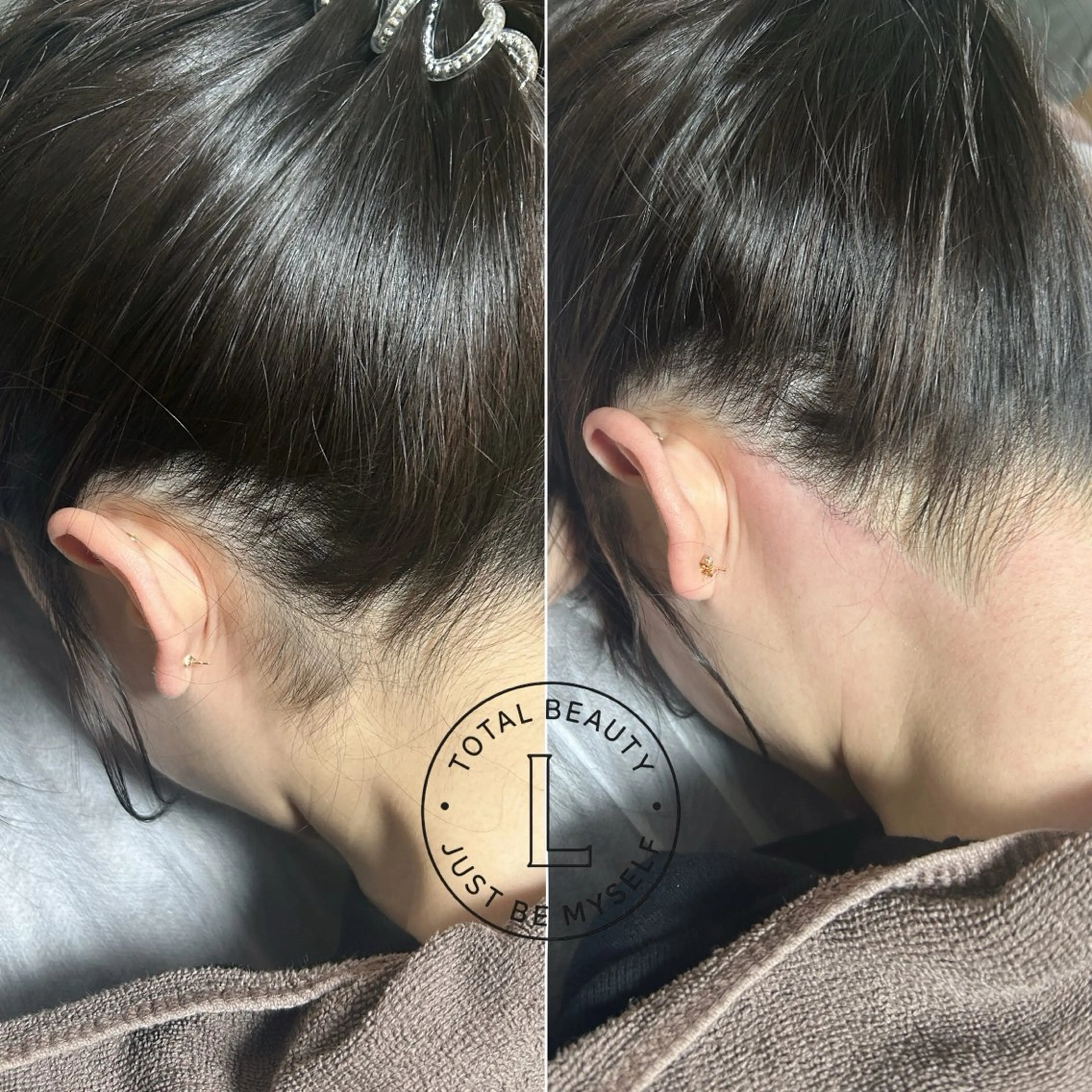 脱毛サロンLULA 恵比寿店　笠松のエステ・リラクイメージ