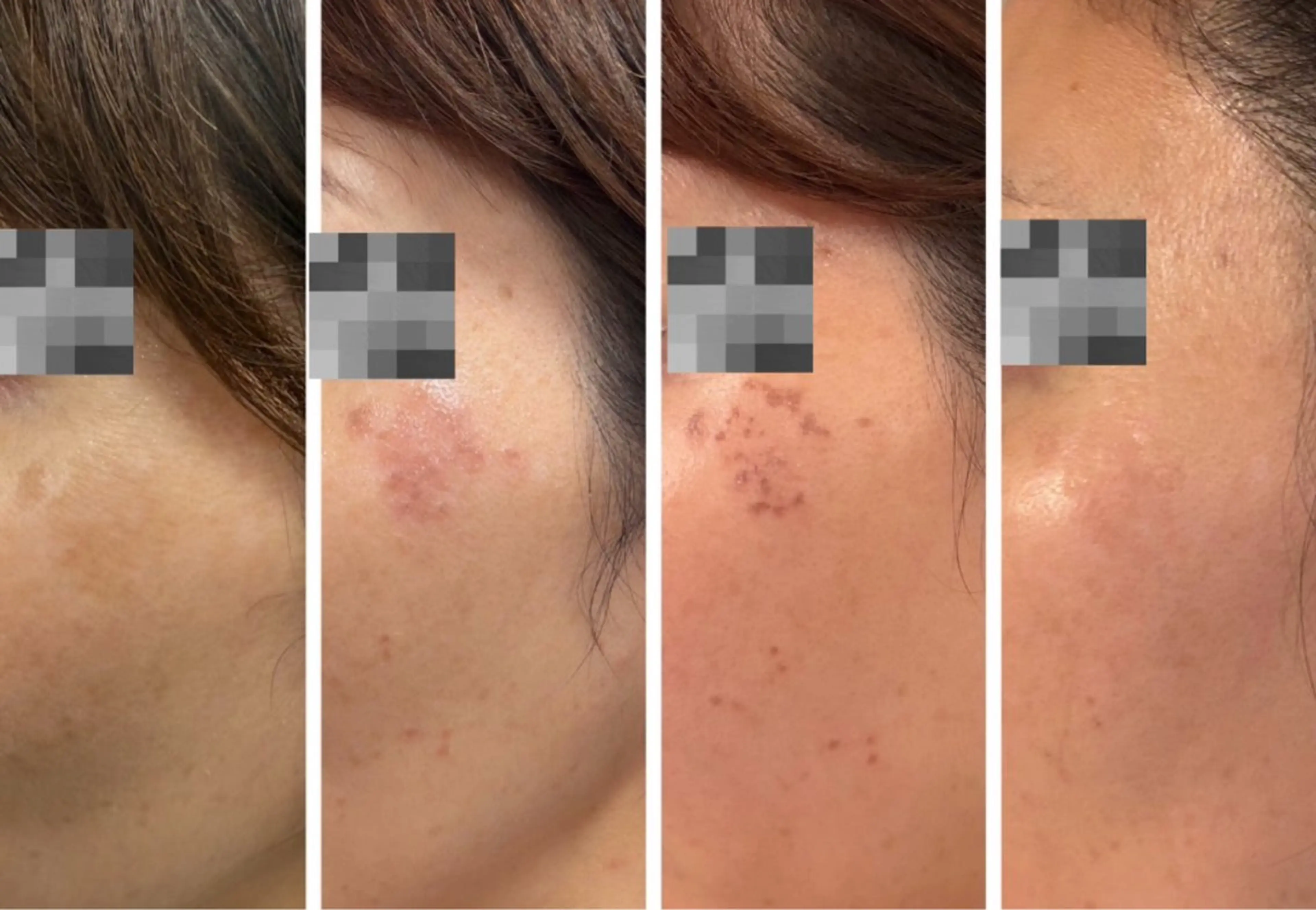 エステ healthy& beautyDEWAのエステ・リラクイメージ