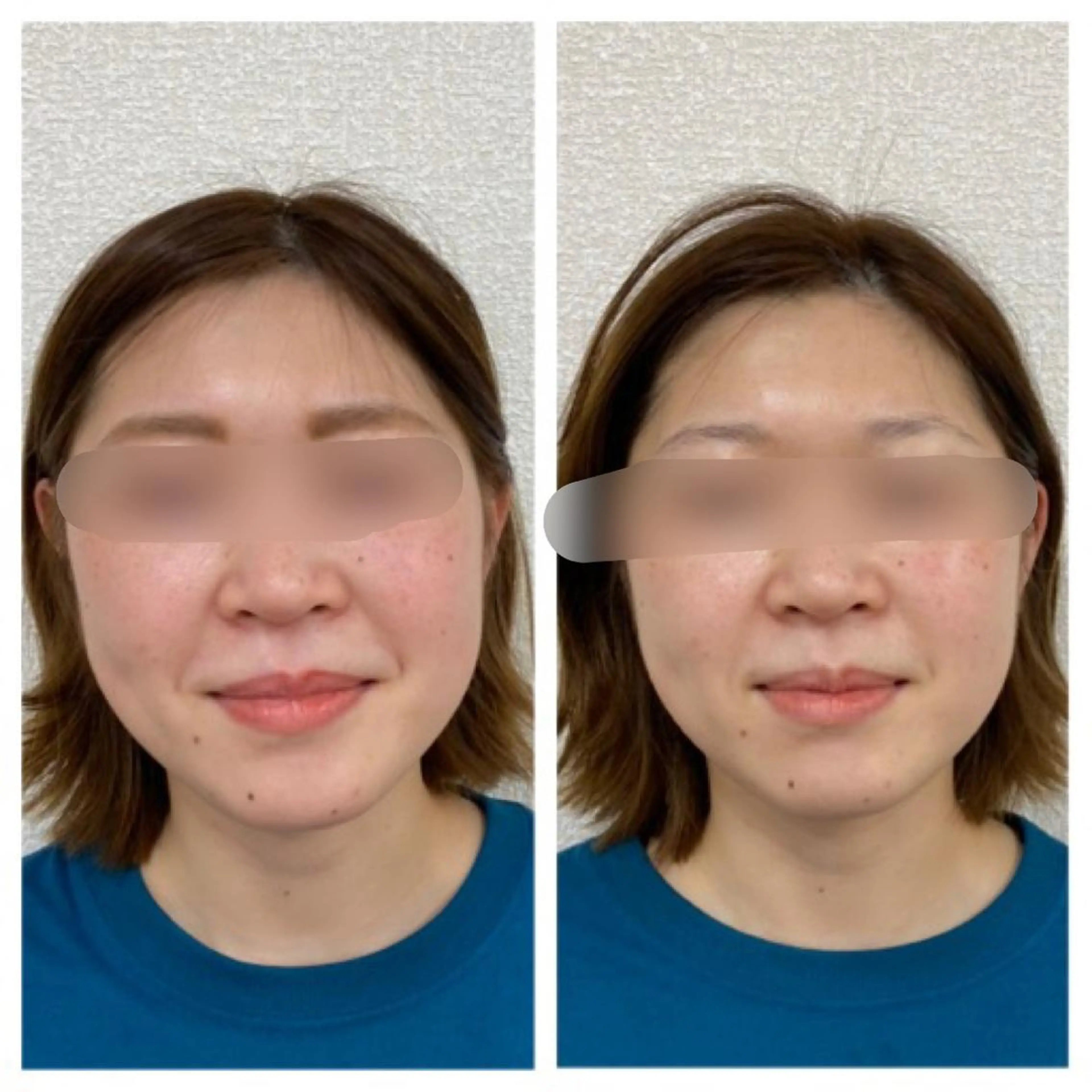 小顔矯正サロン Lilyのエステ・リラクイメージ