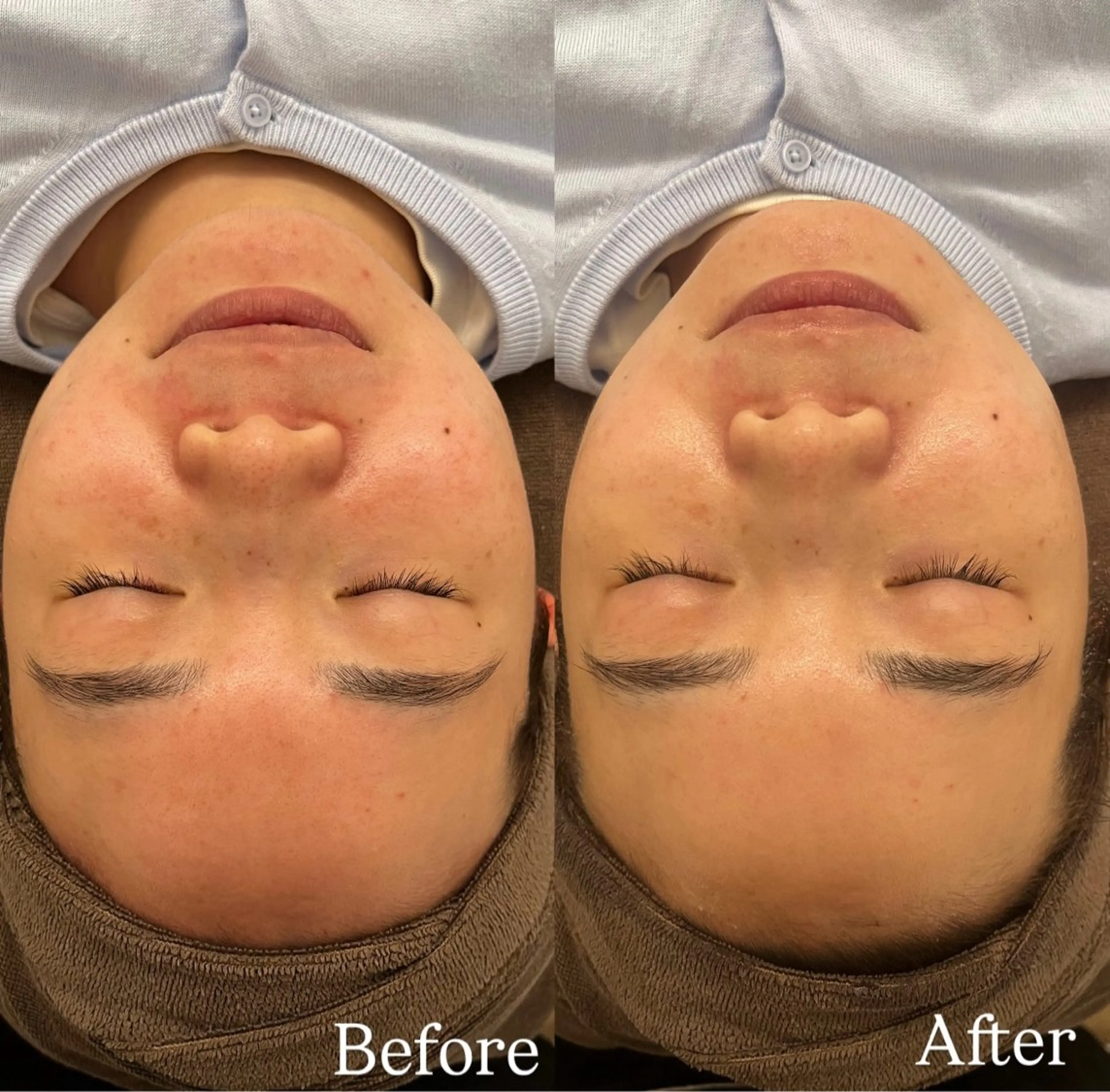 キッズ 脱毛 Dioe 自由が丘のエステ・リラクイメージ