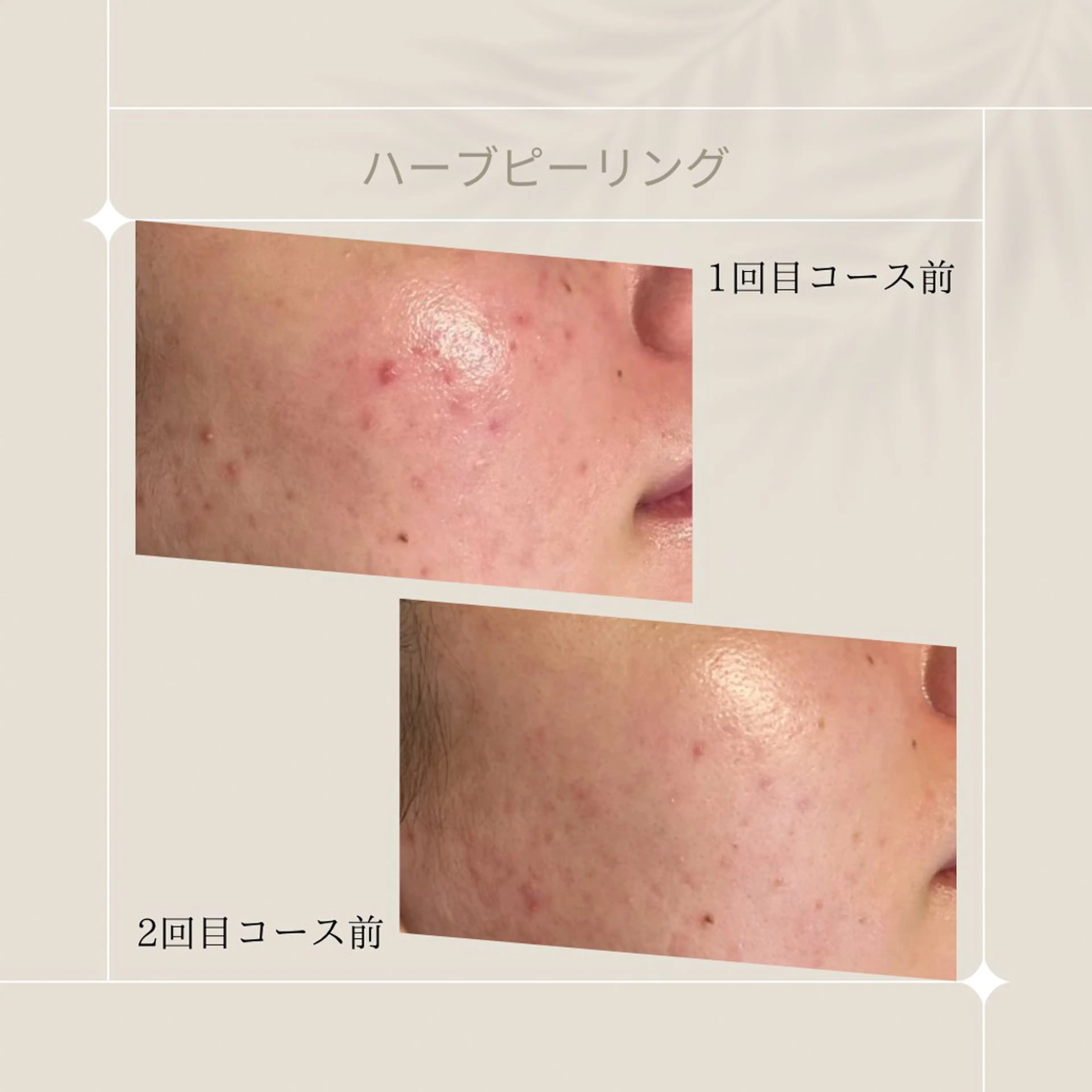 エステ リラク ピーリング専門店 Belluteのエステ・リラクイメージ