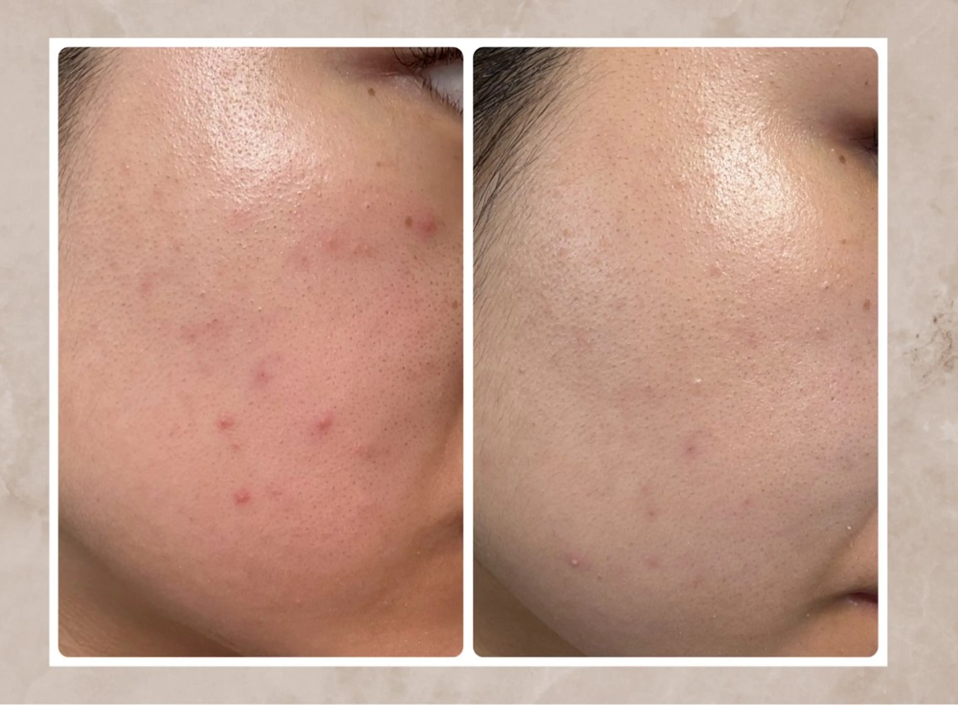 Vi's CLUB KOTONOのエステ・リラクイメージ