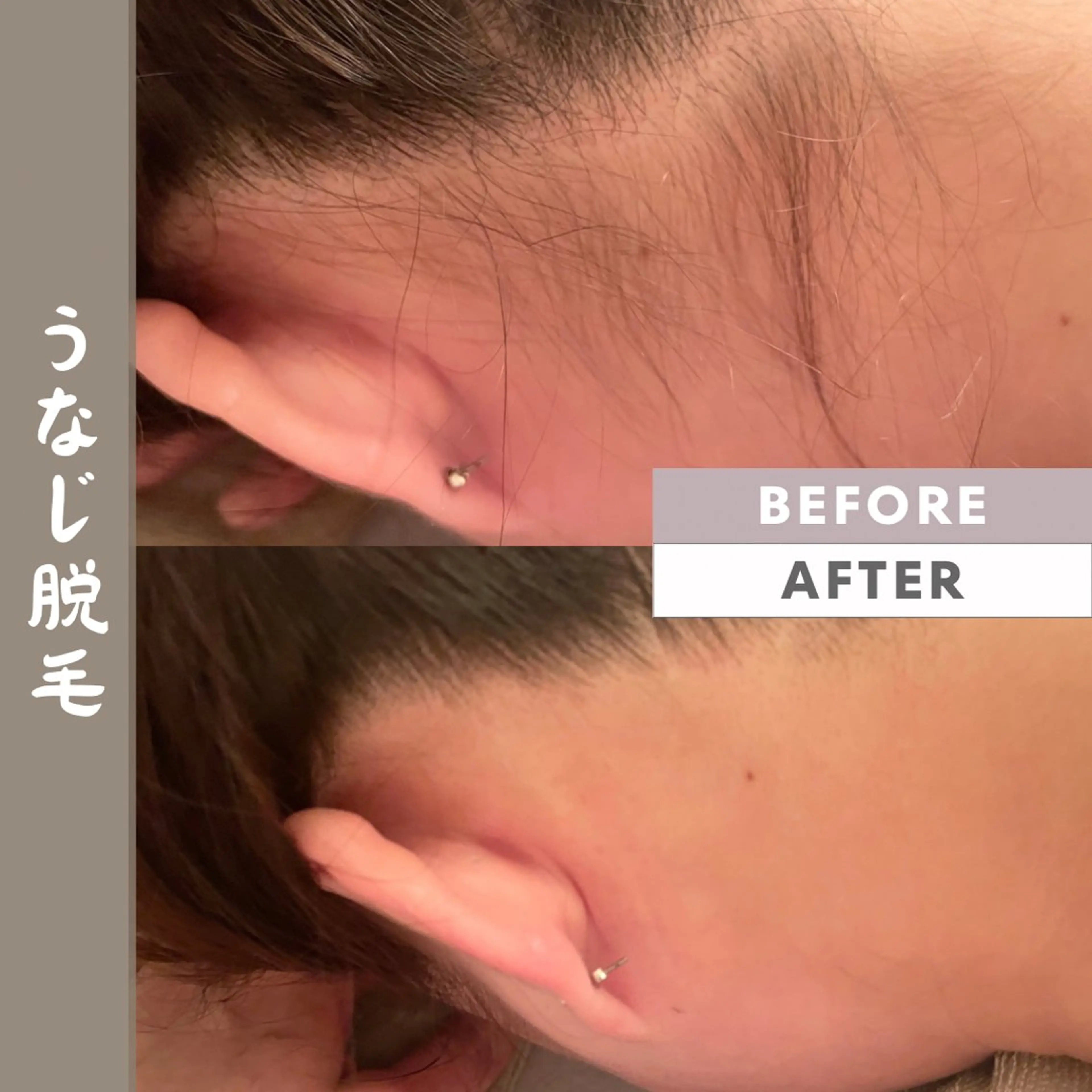 LONO byalittleのエステ・リラクイメージ