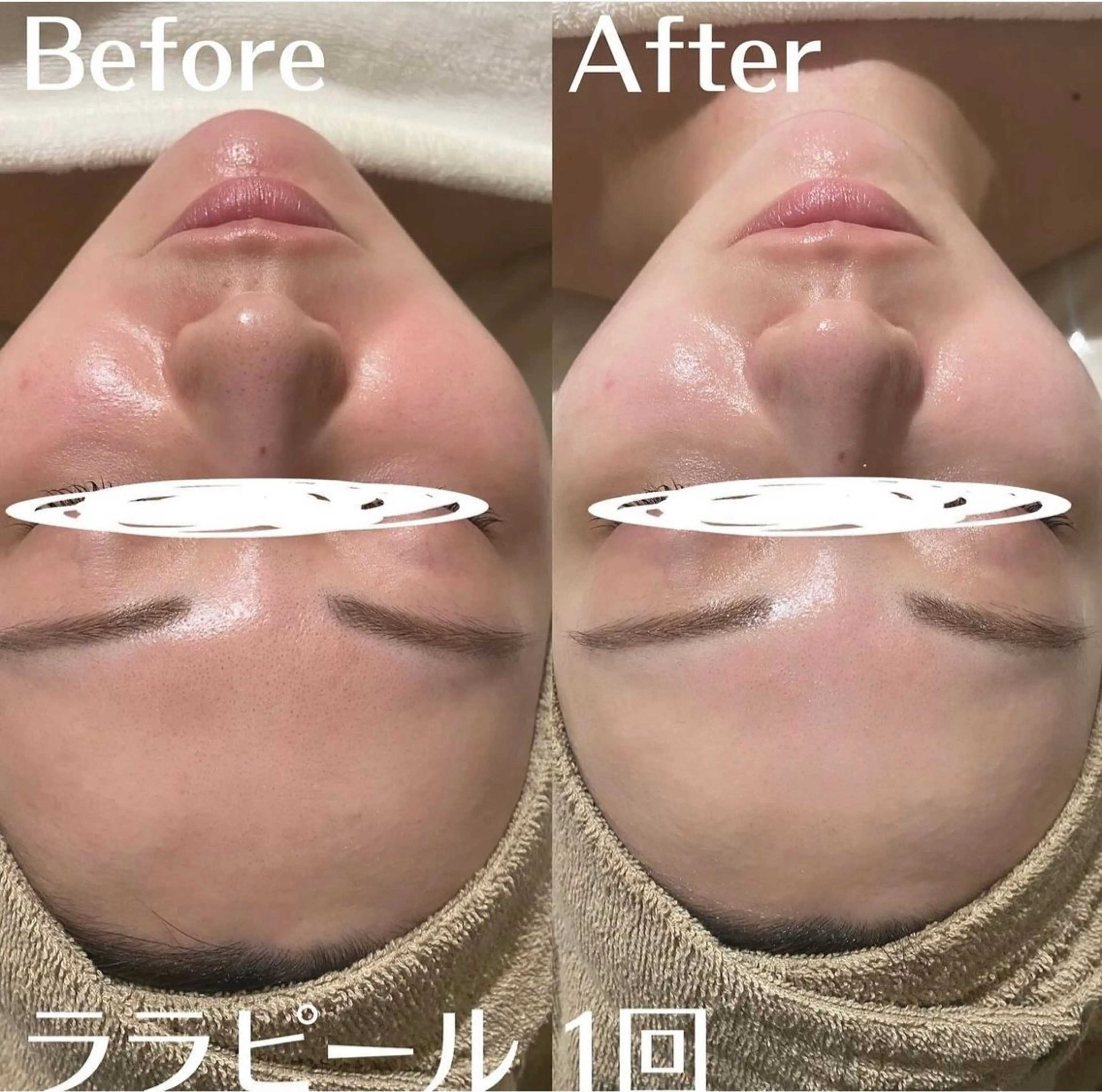 中目黒ハーブピーリン グ🌿ララピールのエステ・リラクイメージ