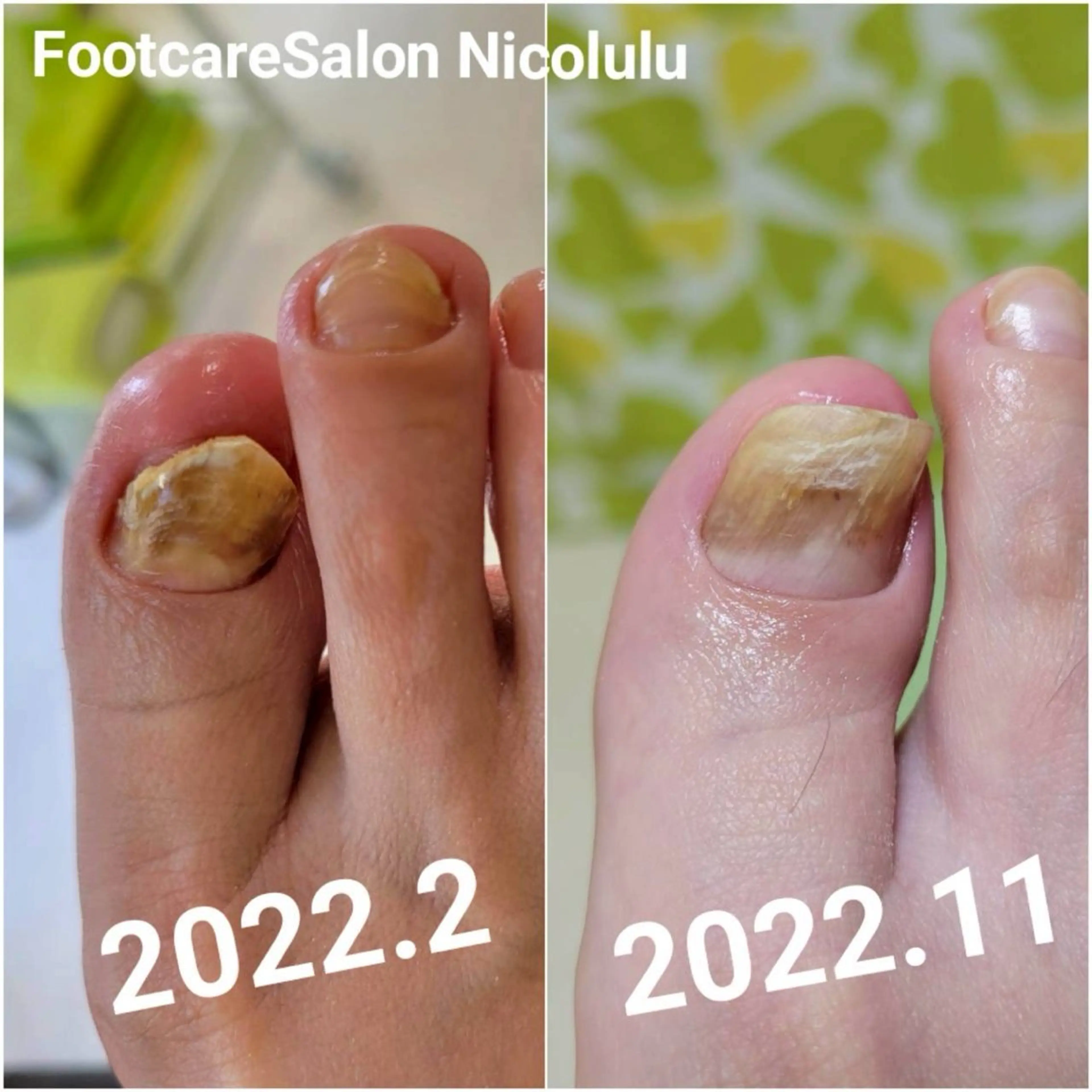 リラク 足トラブル専門 ニコルル金沢のエステ・リラクイメージ